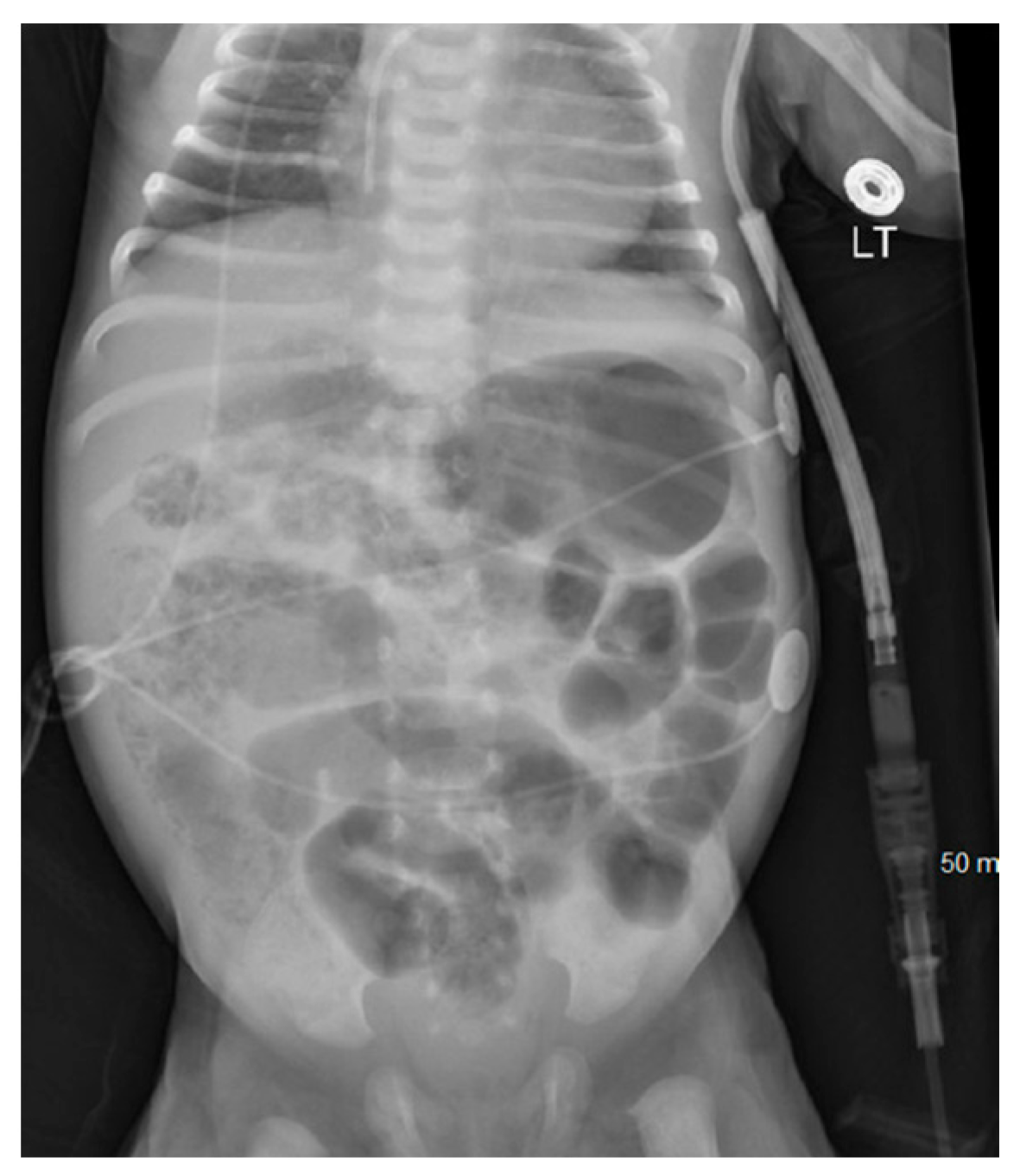 Pediatrrep 16 00065 g003