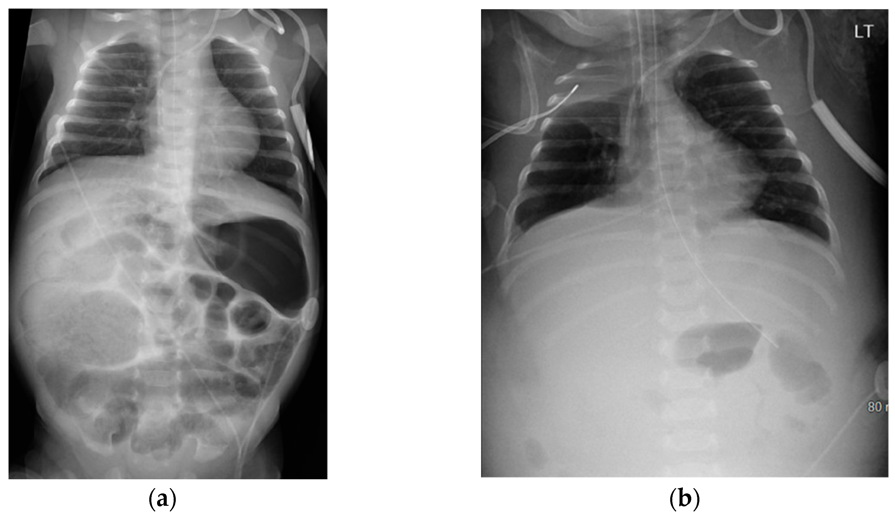 Pediatrrep 16 00065 g004