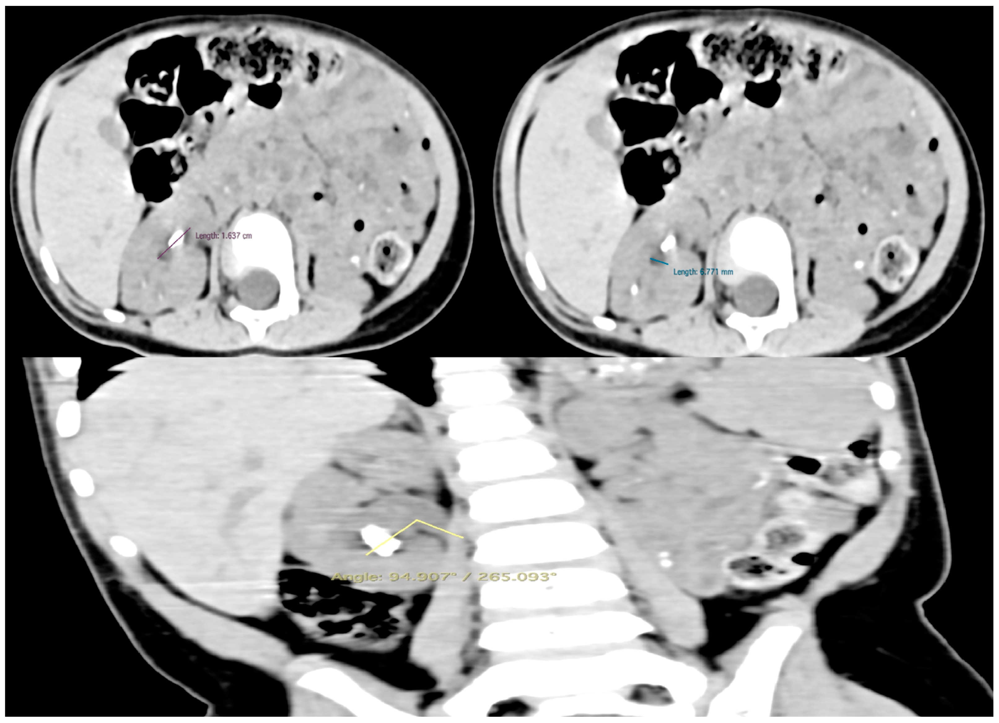 Pediatrrep 16 00068 g003