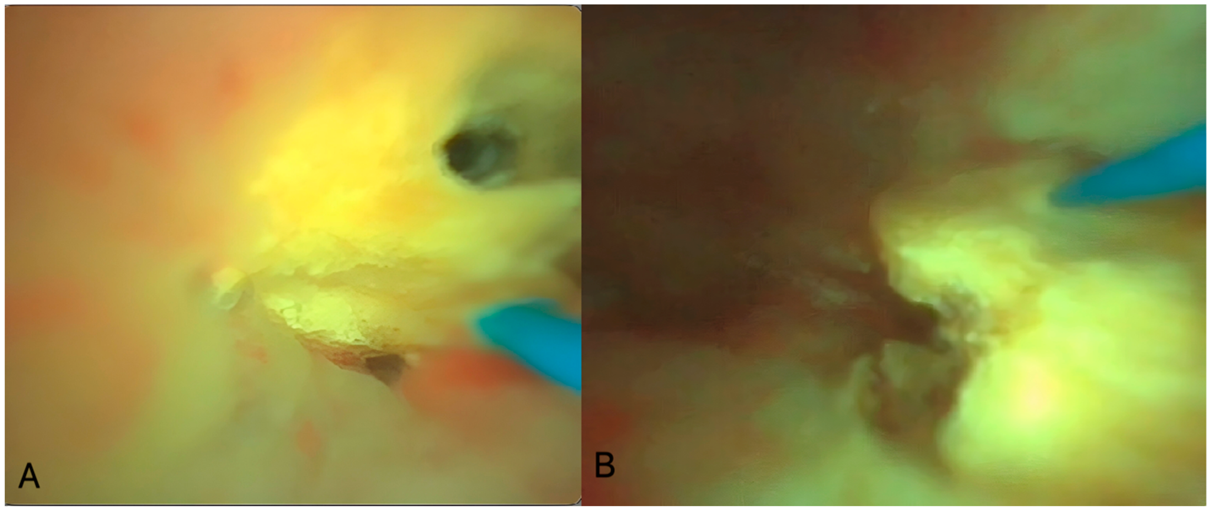 Pediatrrep 16 00068 g004