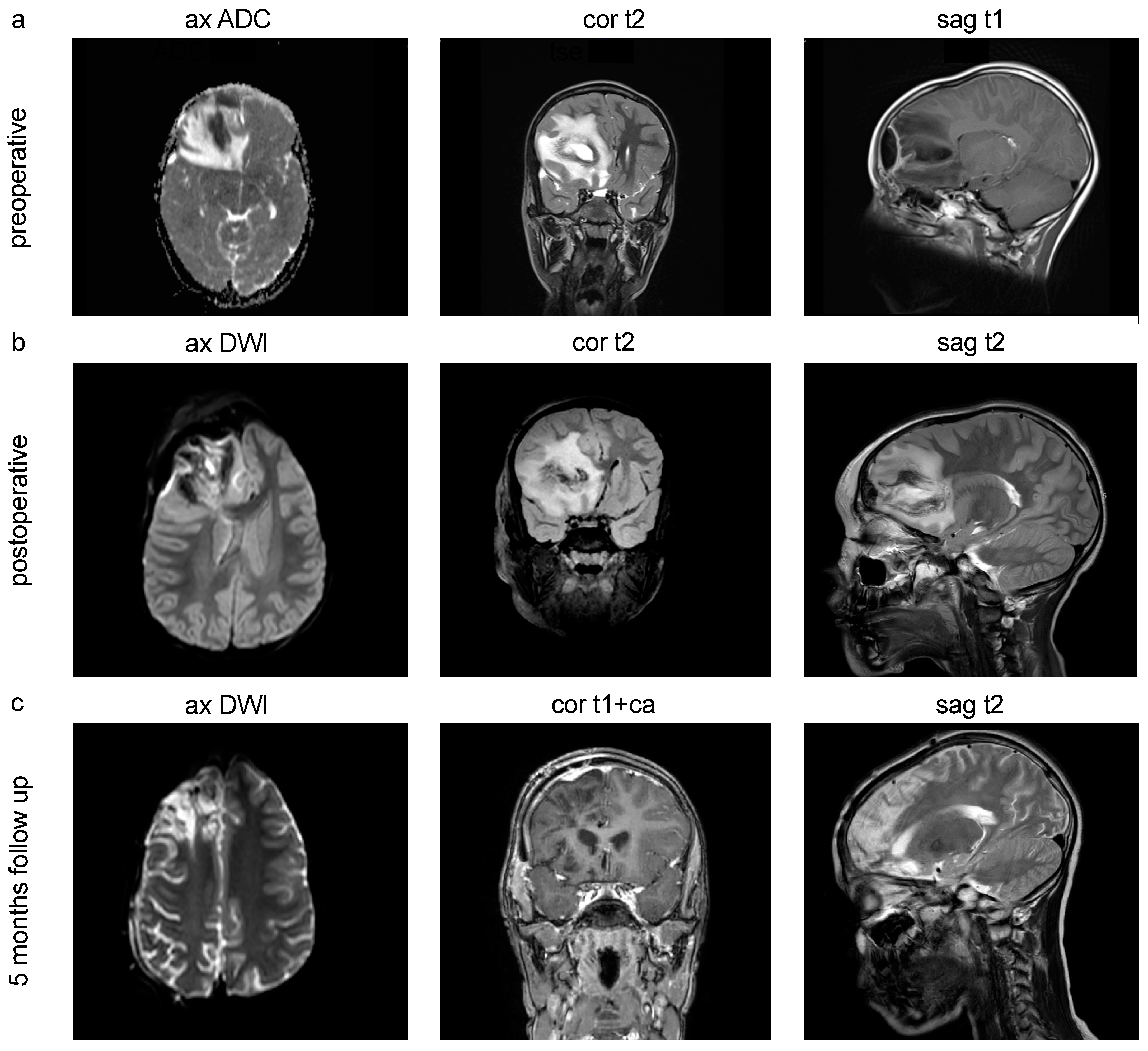 Pediatrrep 16 00085 g002