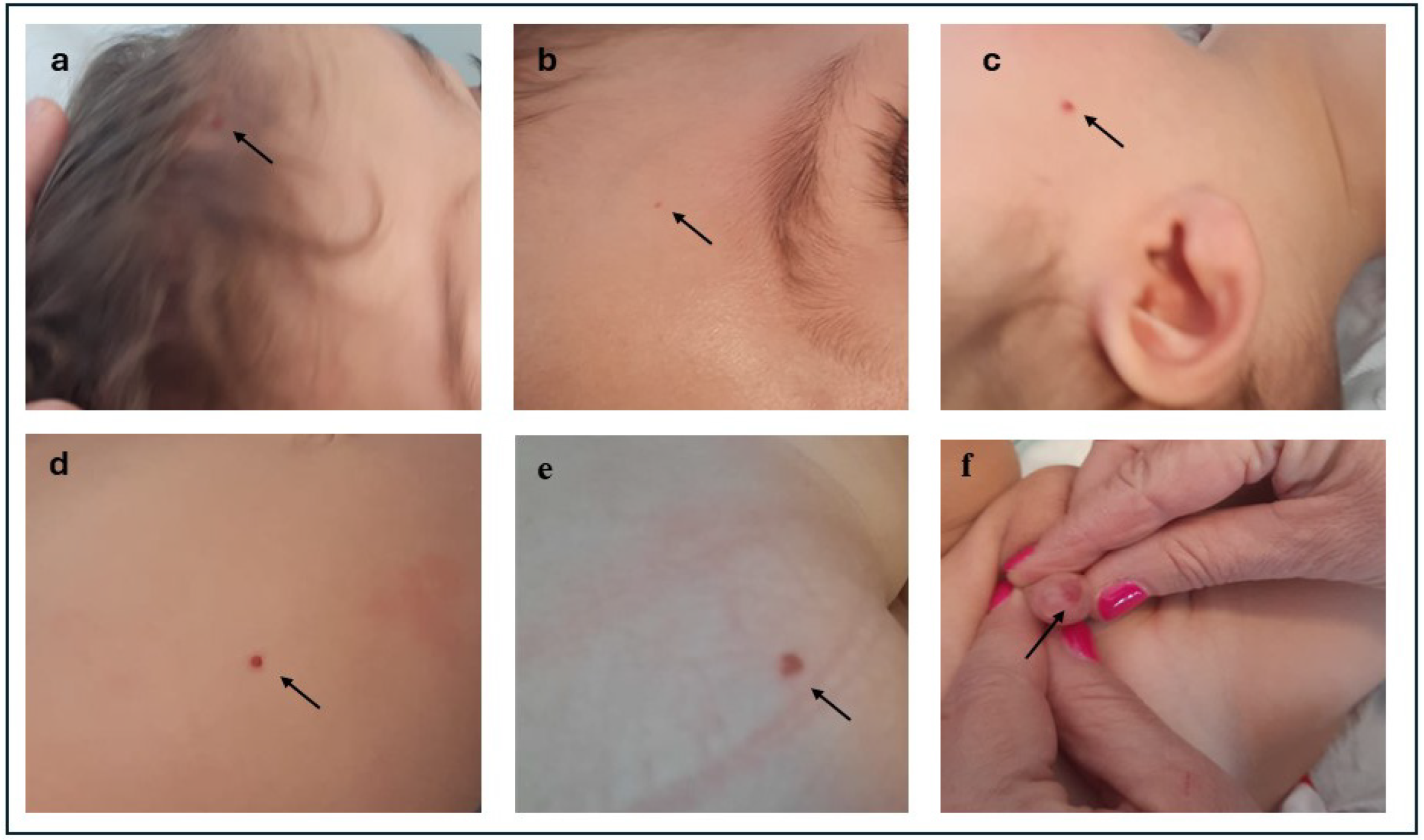 Pediatrrep 16 00101 g001