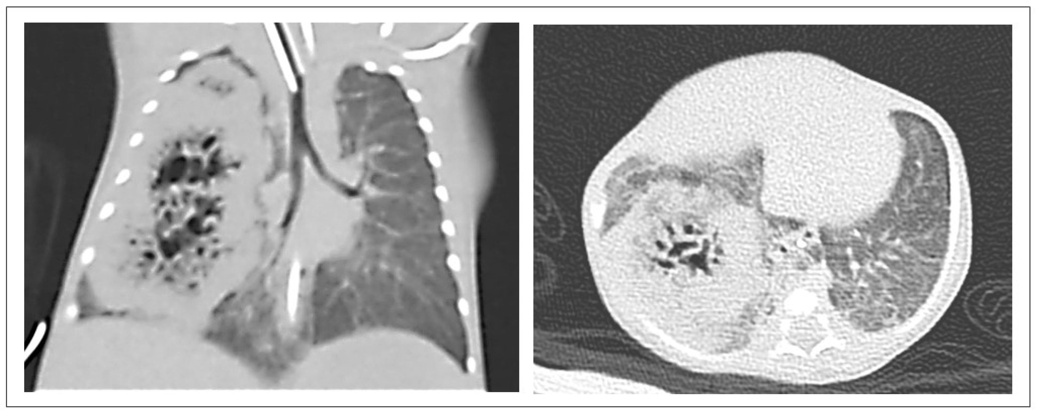 Pediatrrep 17 00005 g004