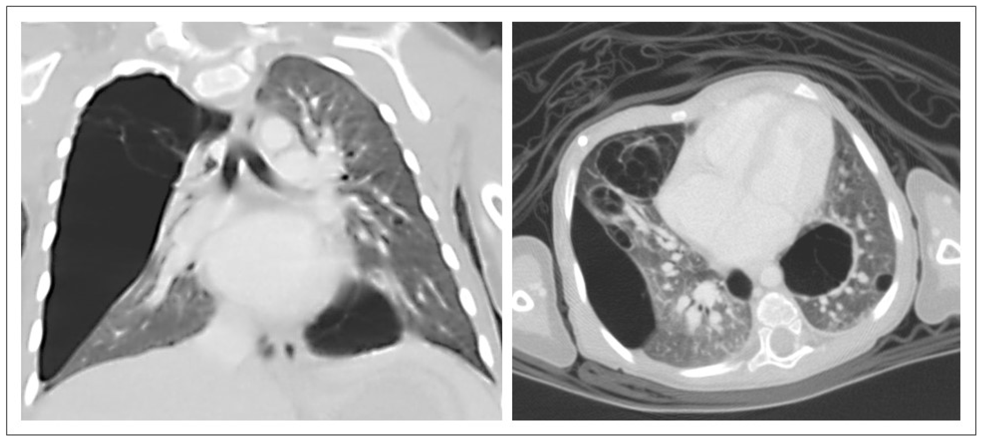 Pediatrrep 17 00005 g005