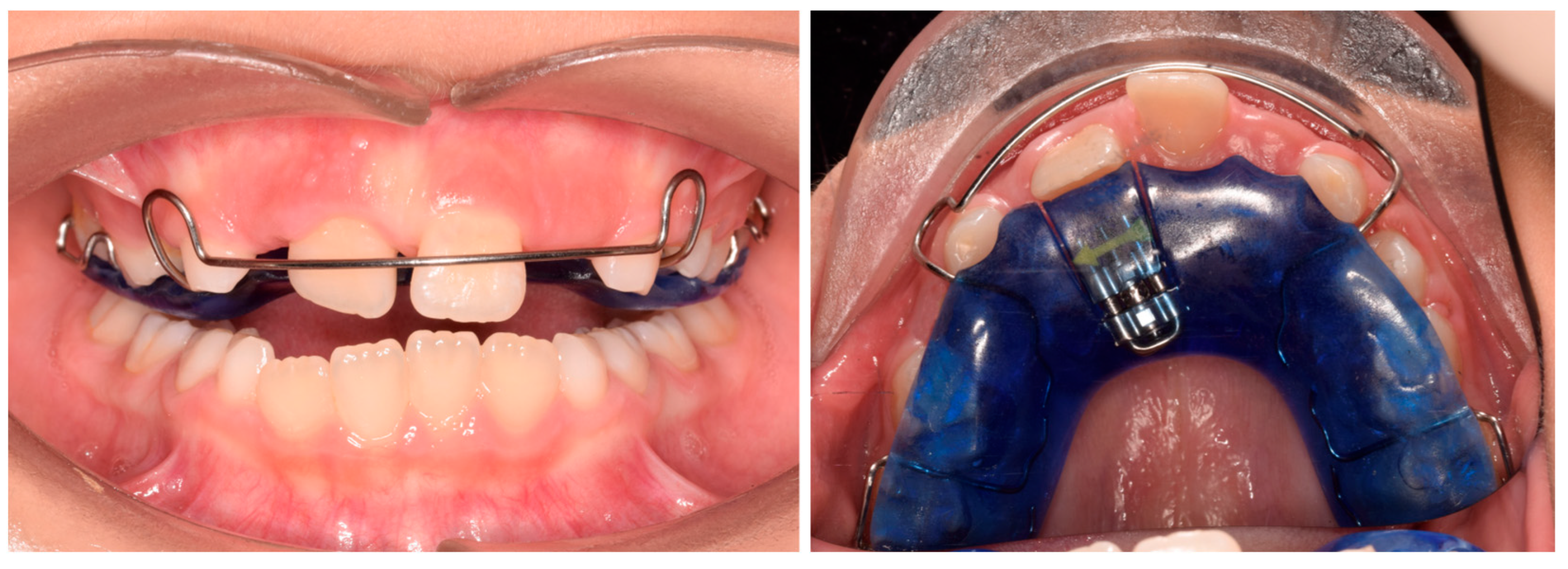 Pediatrrep 17 00011 g002