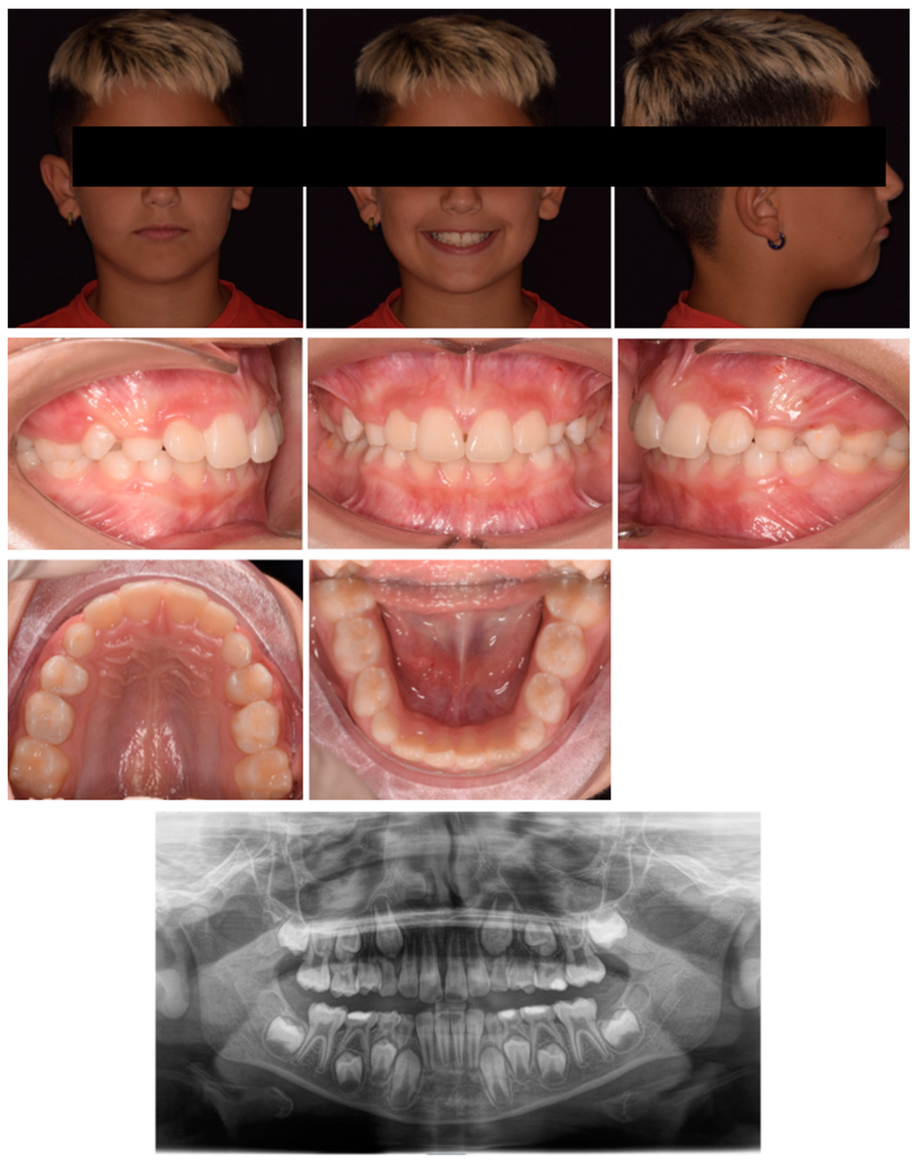 Pediatrrep 17 00011 g004