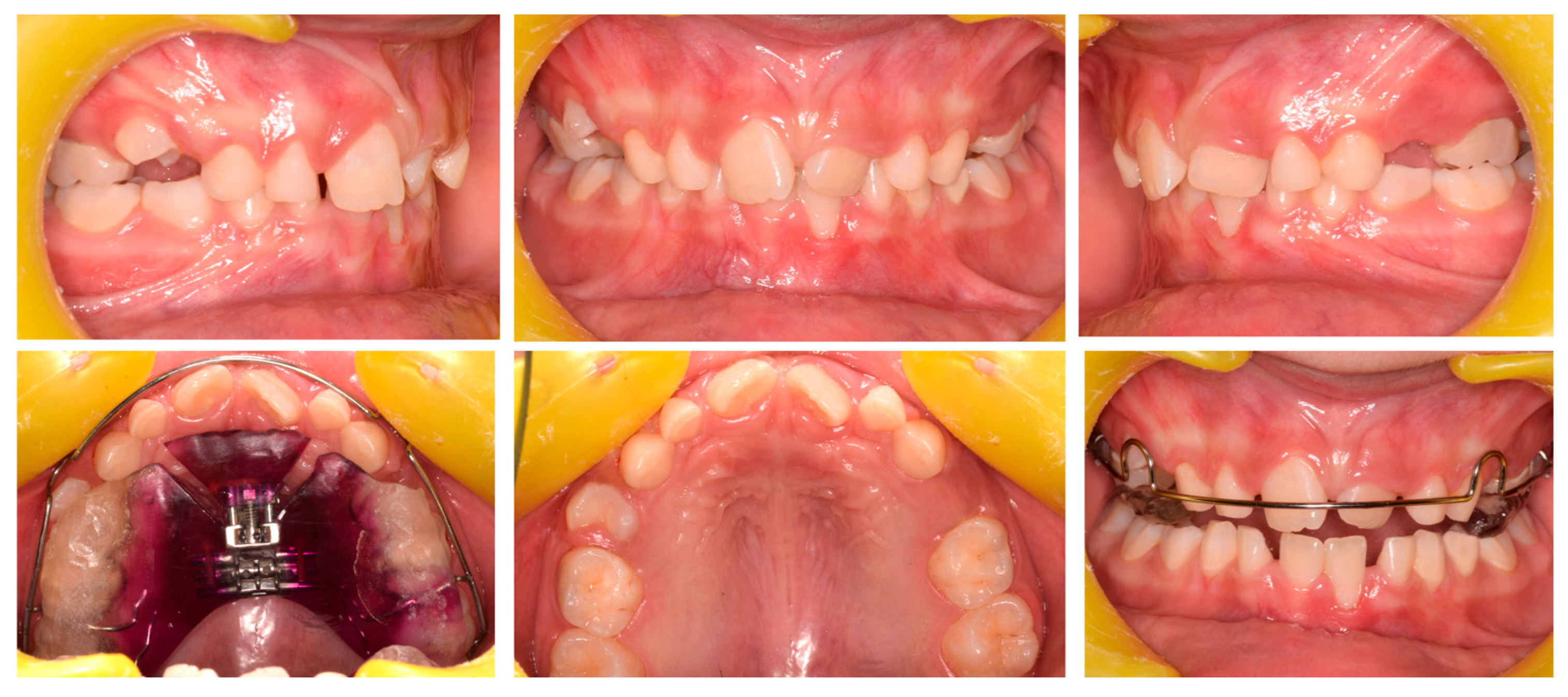 Pediatrrep 17 00011 g010