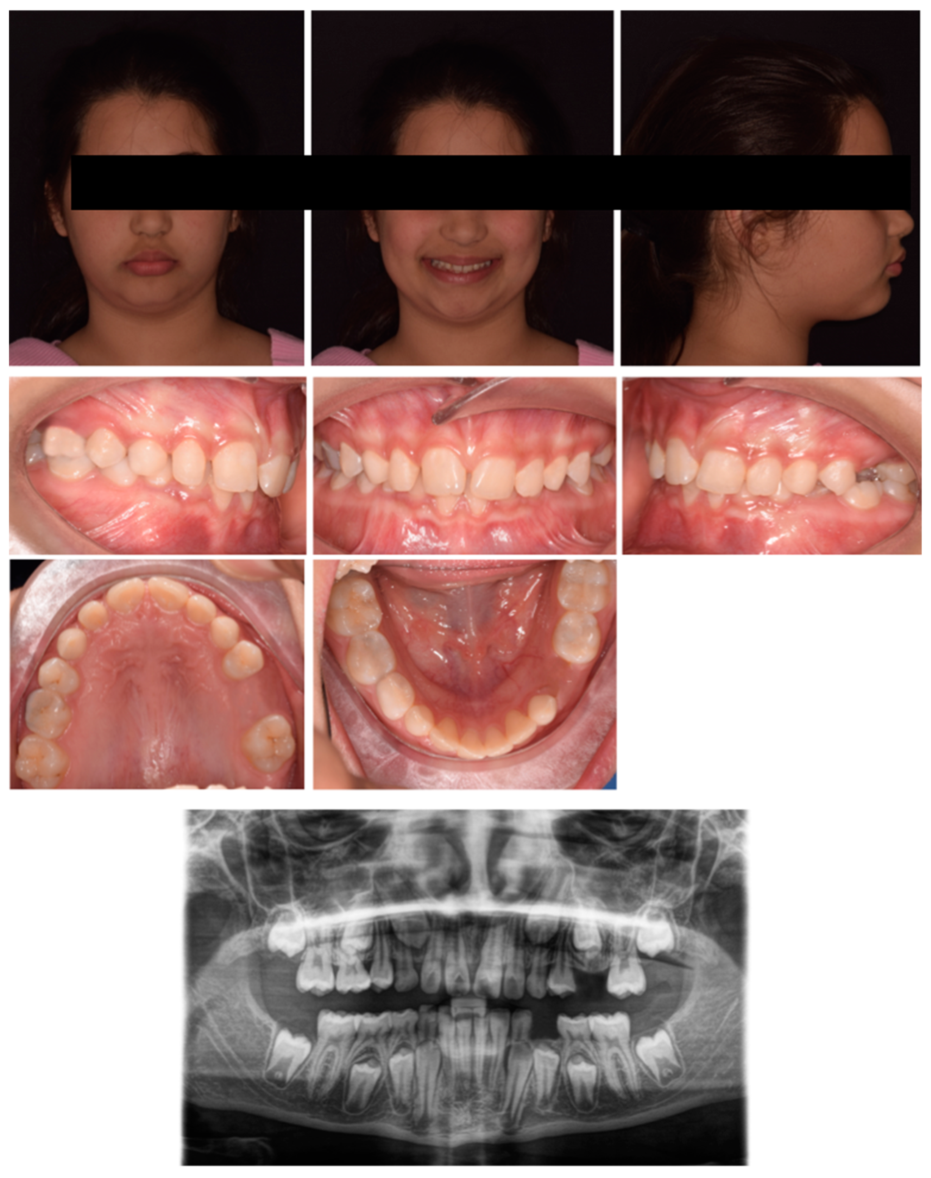 Pediatrrep 17 00011 g011