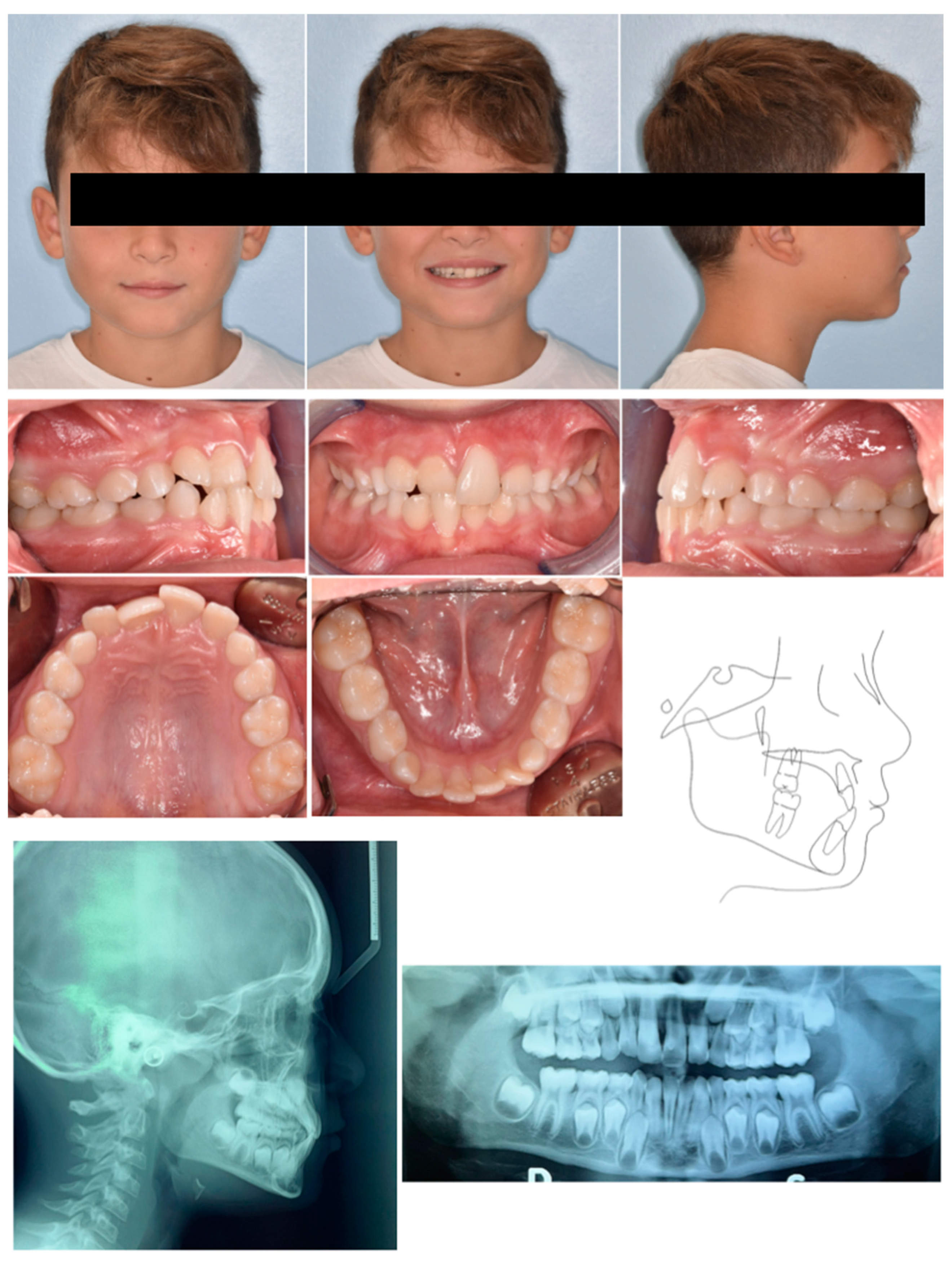 Pediatrrep 17 00011 g012