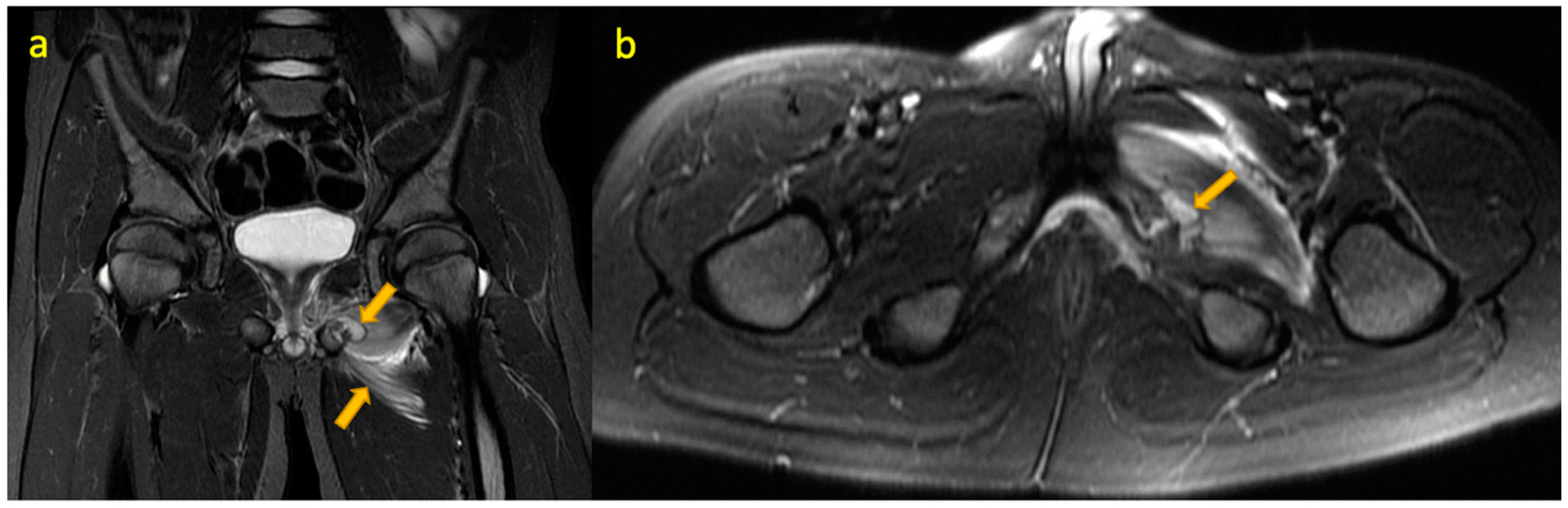 Pediatrrep 17 00014 g001