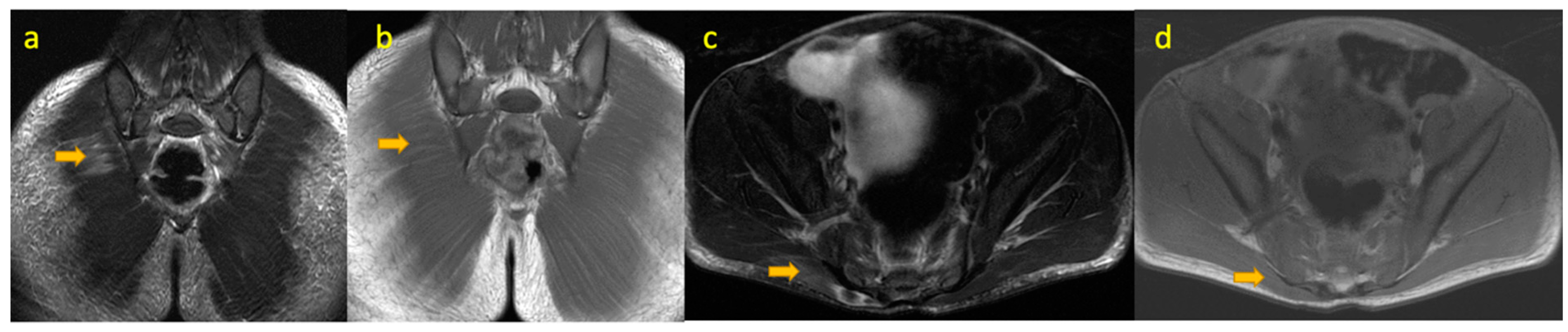 Pediatrrep 17 00014 g003