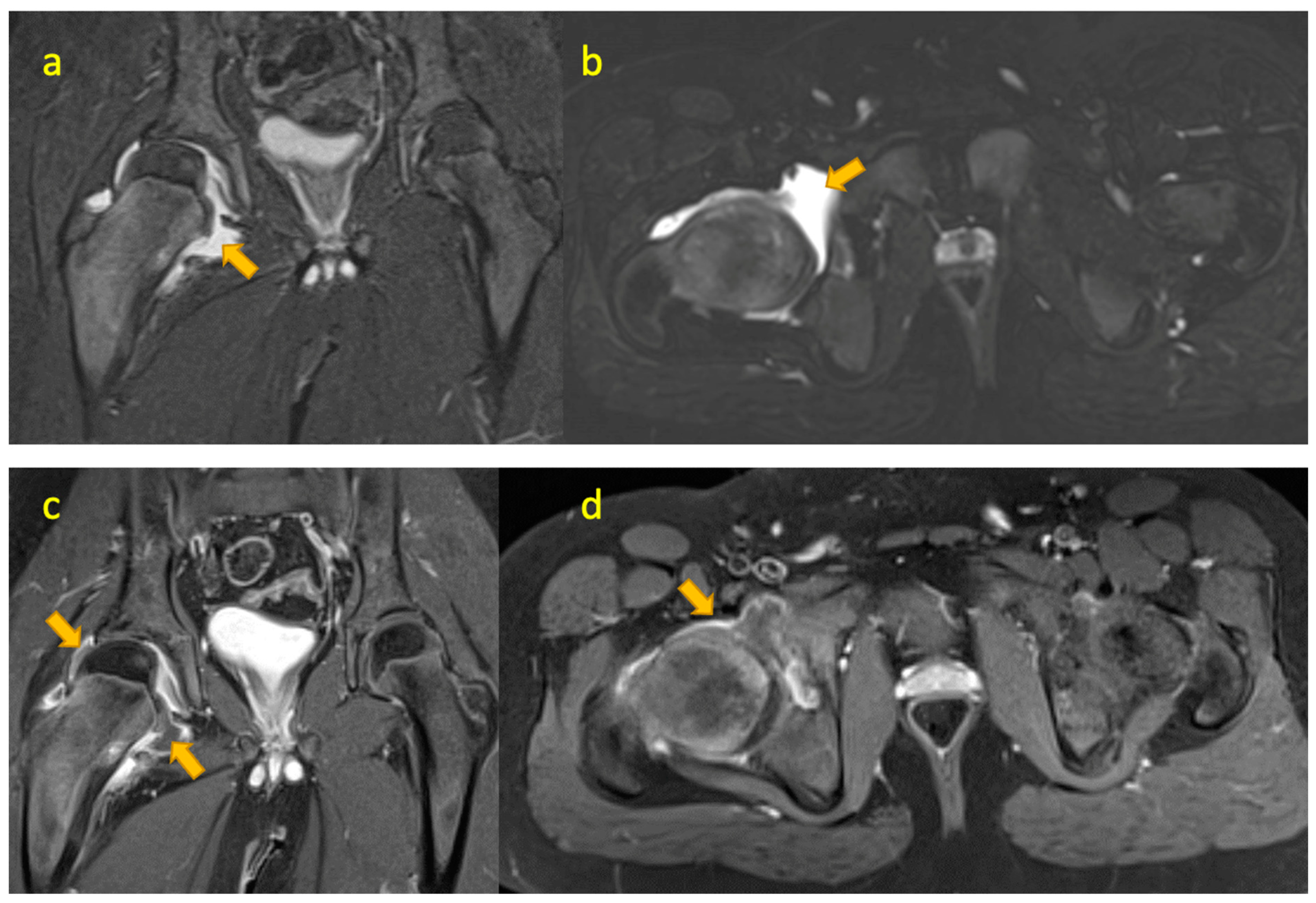 Pediatrrep 17 00014 g004