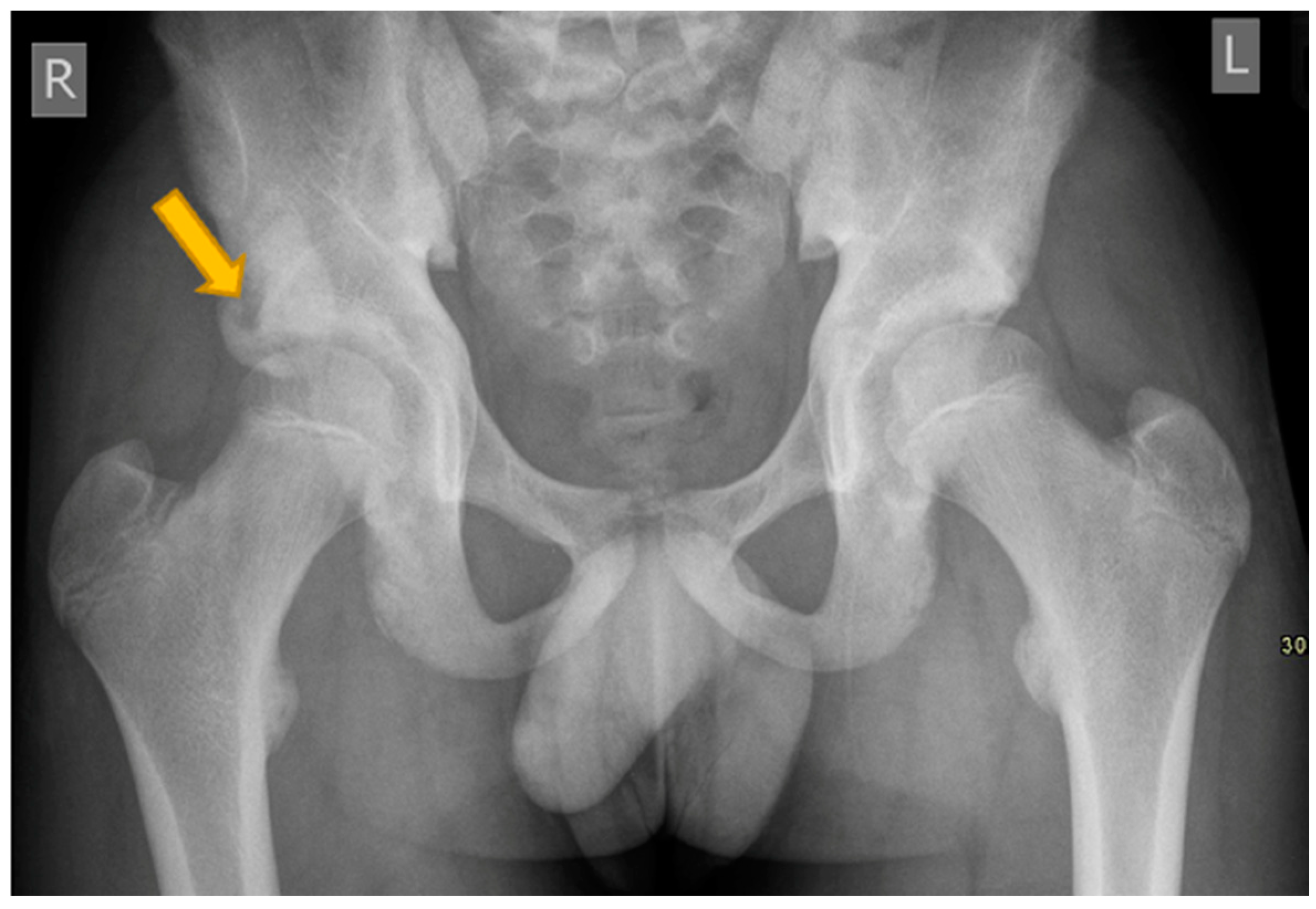 Pediatrrep 17 00014 g005