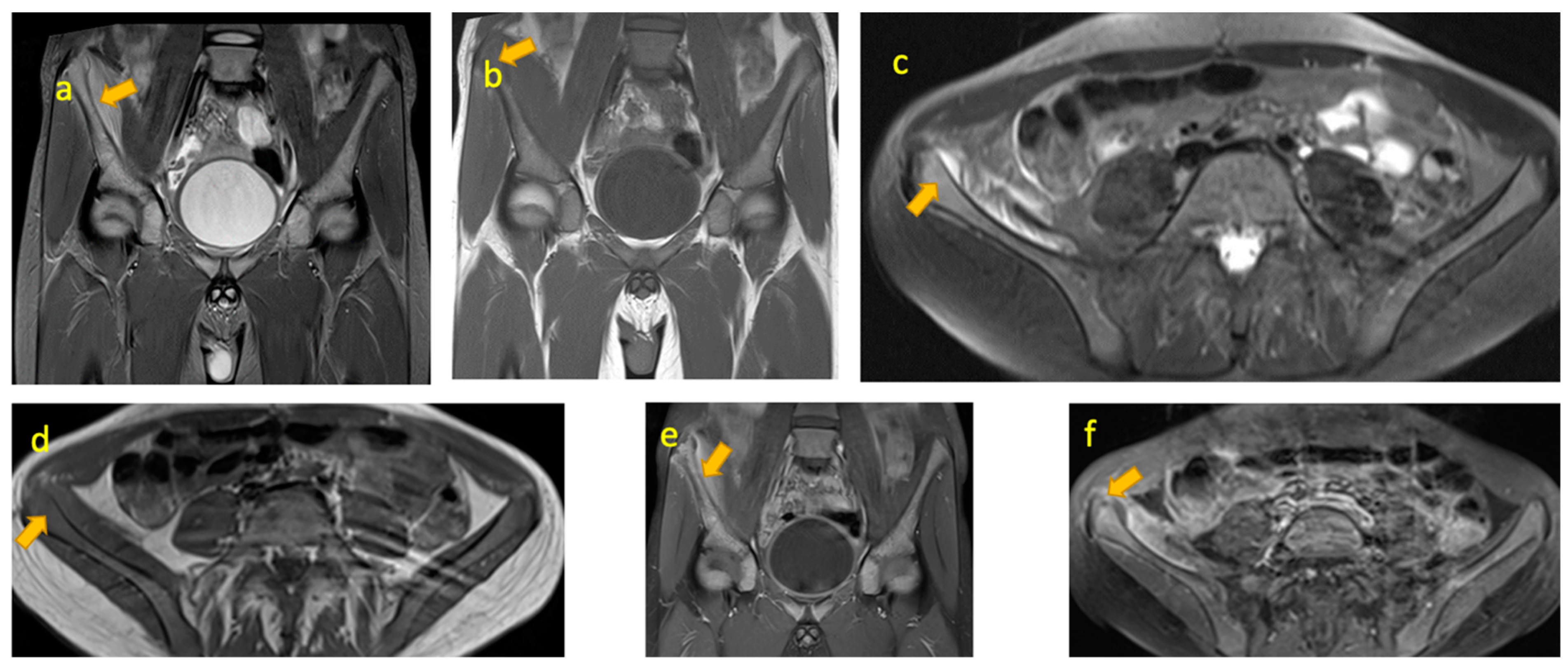 Pediatrrep 17 00014 g007