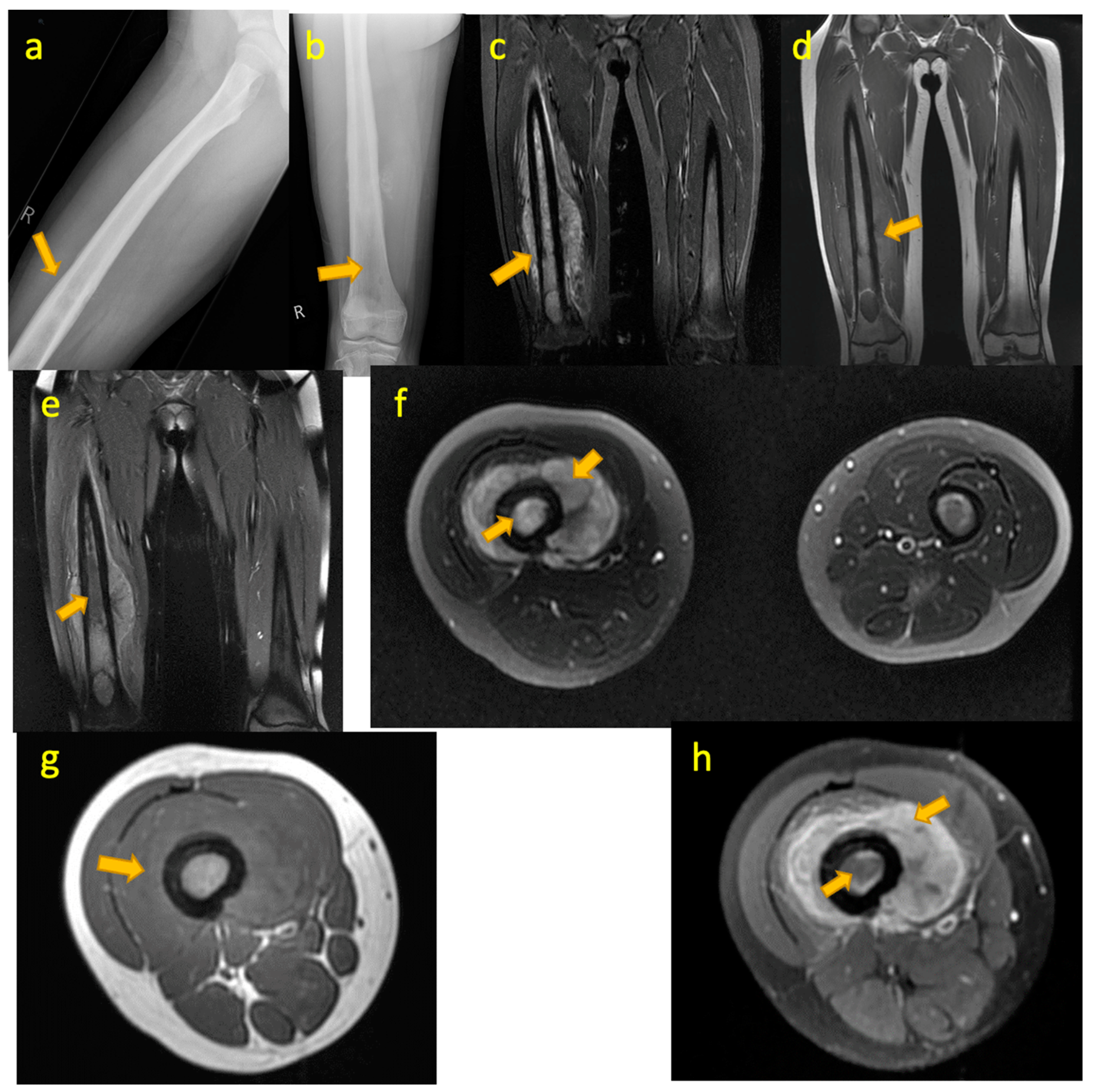 Pediatrrep 17 00014 g008