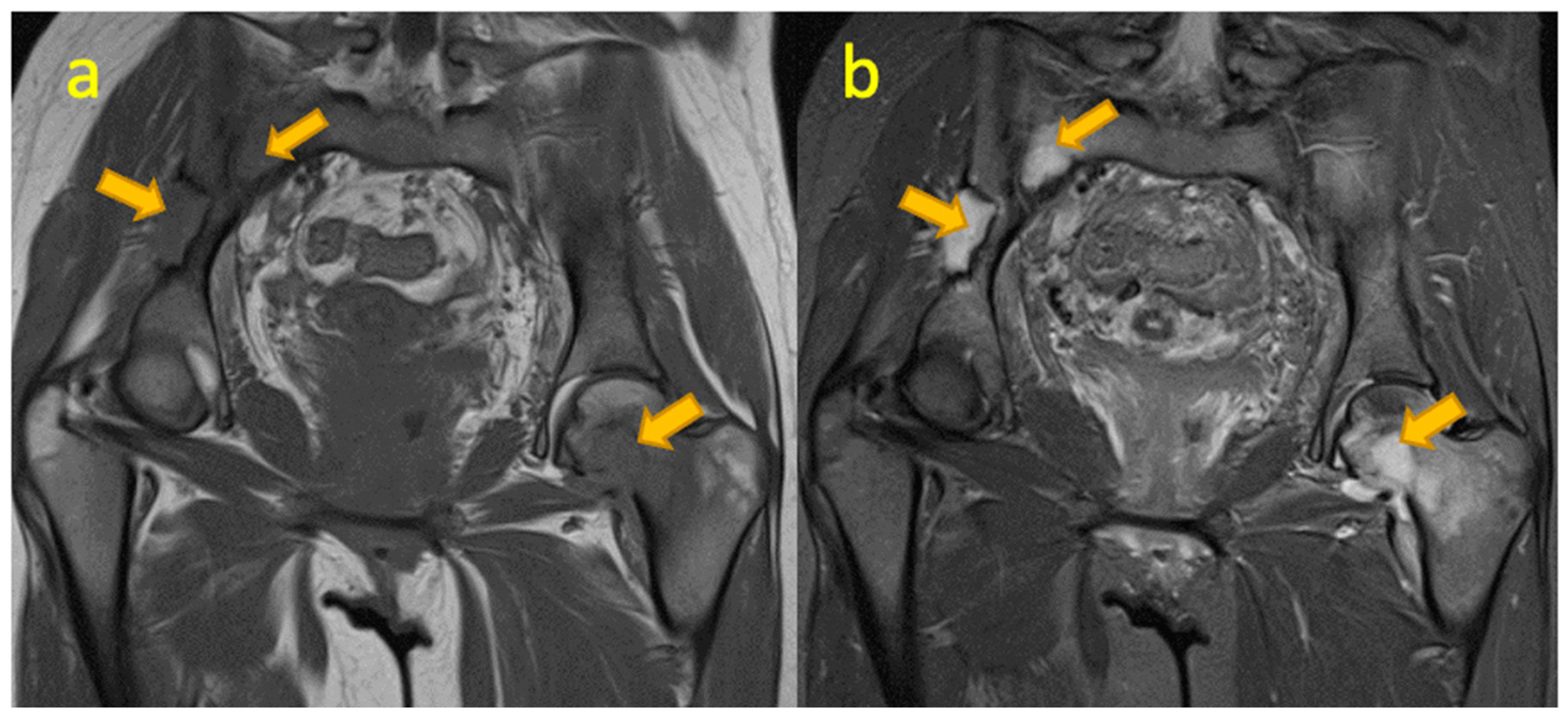 Pediatrrep 17 00014 g009
