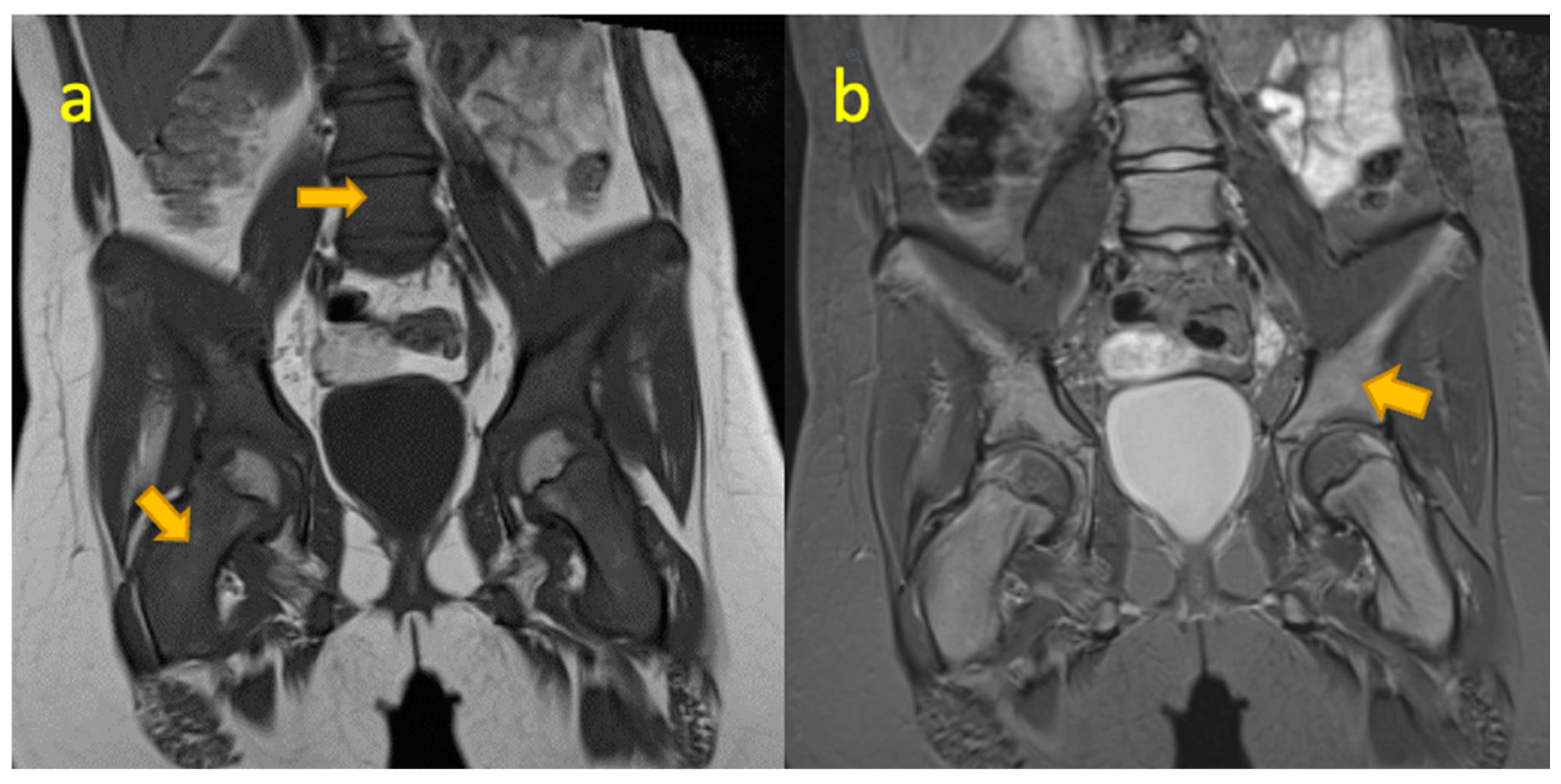 Pediatrrep 17 00014 g010
