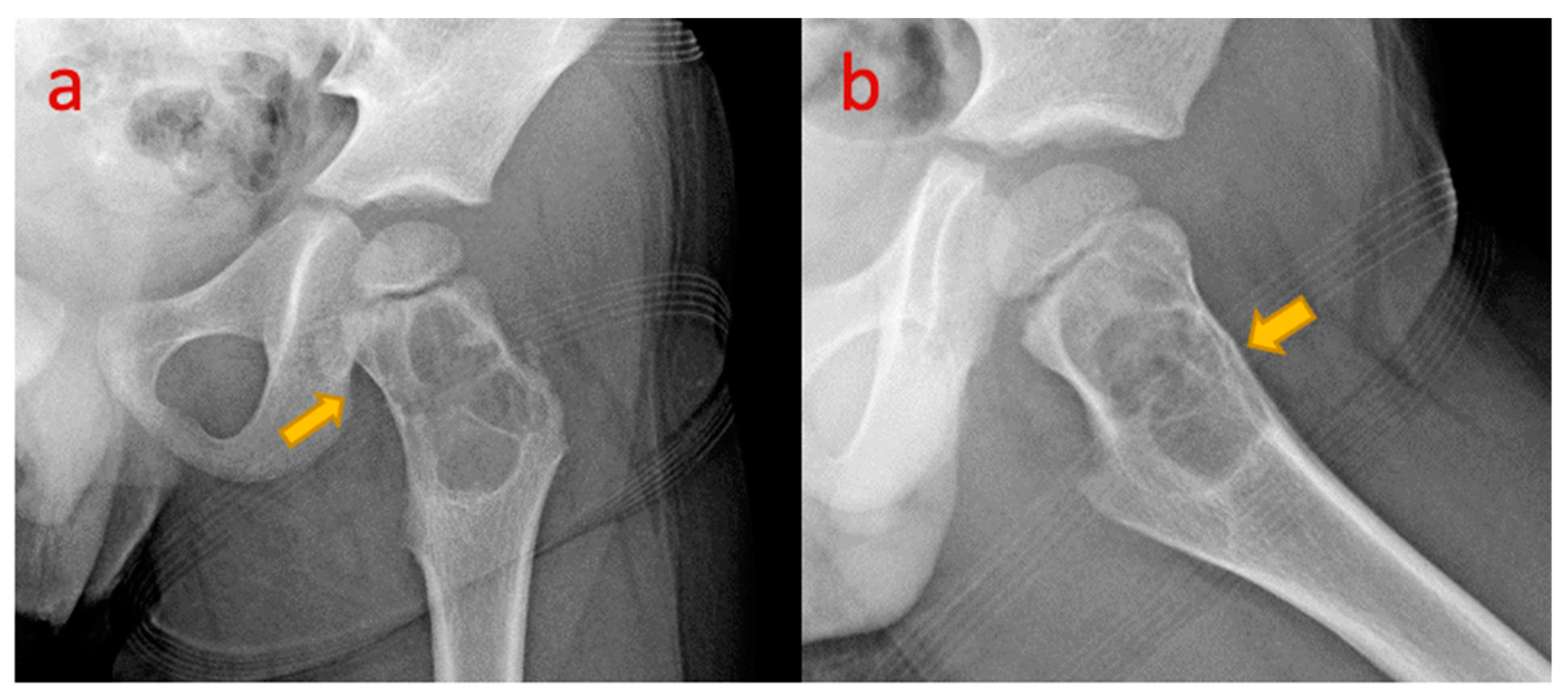 Pediatrrep 17 00014 g011