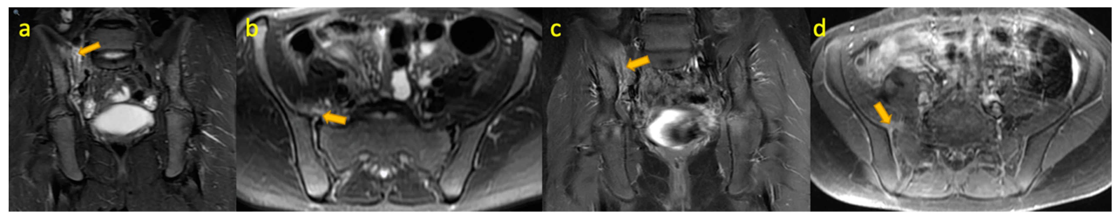 Pediatrrep 17 00014 g012