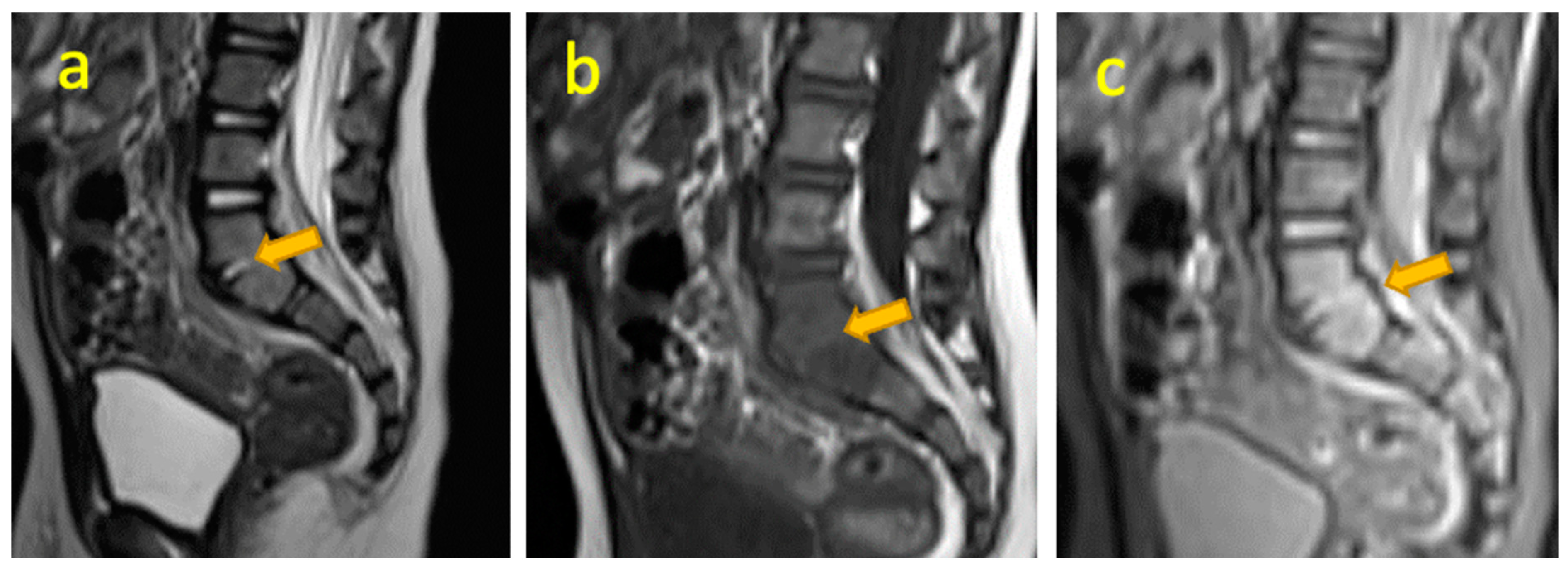 Pediatrrep 17 00014 g013