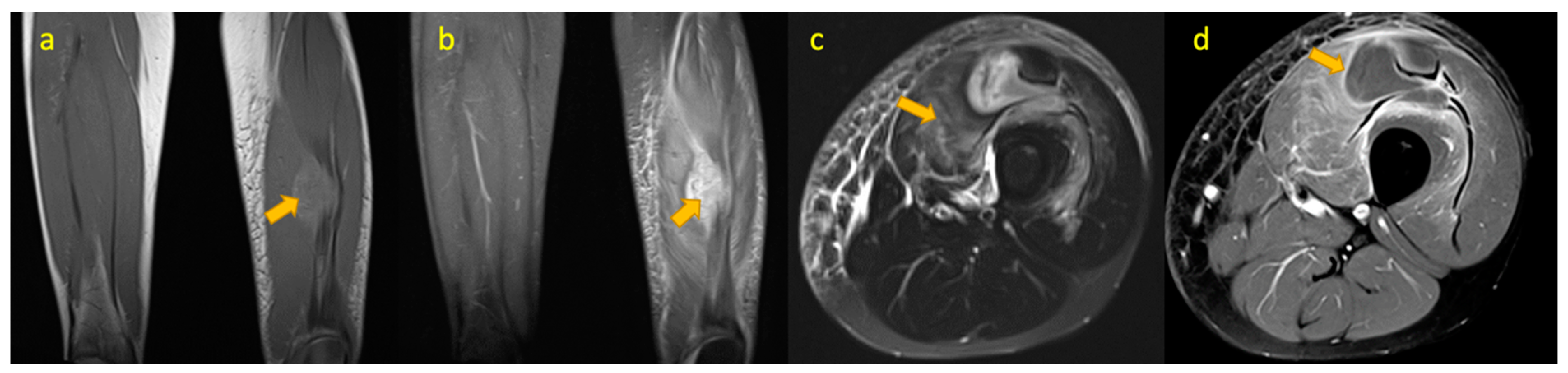 Pediatrrep 17 00014 g014