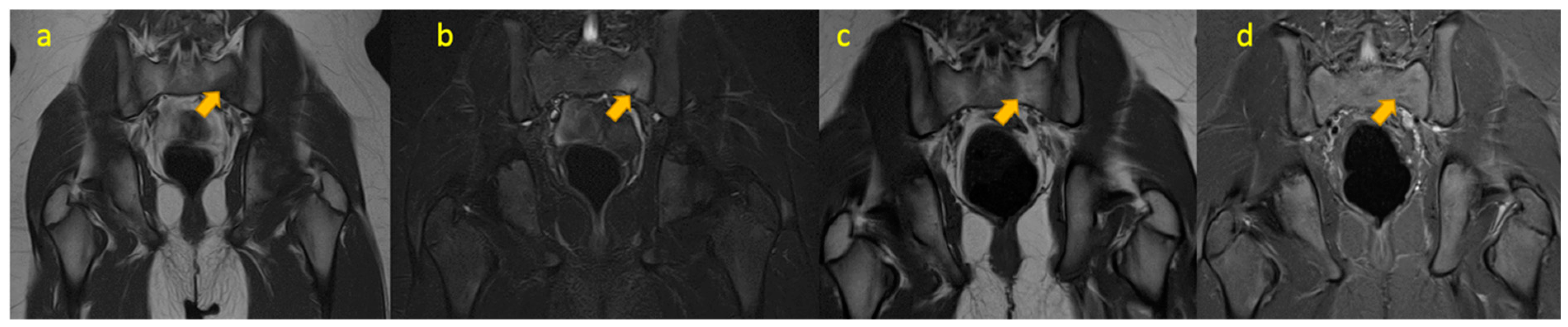 Pediatrrep 17 00014 g015