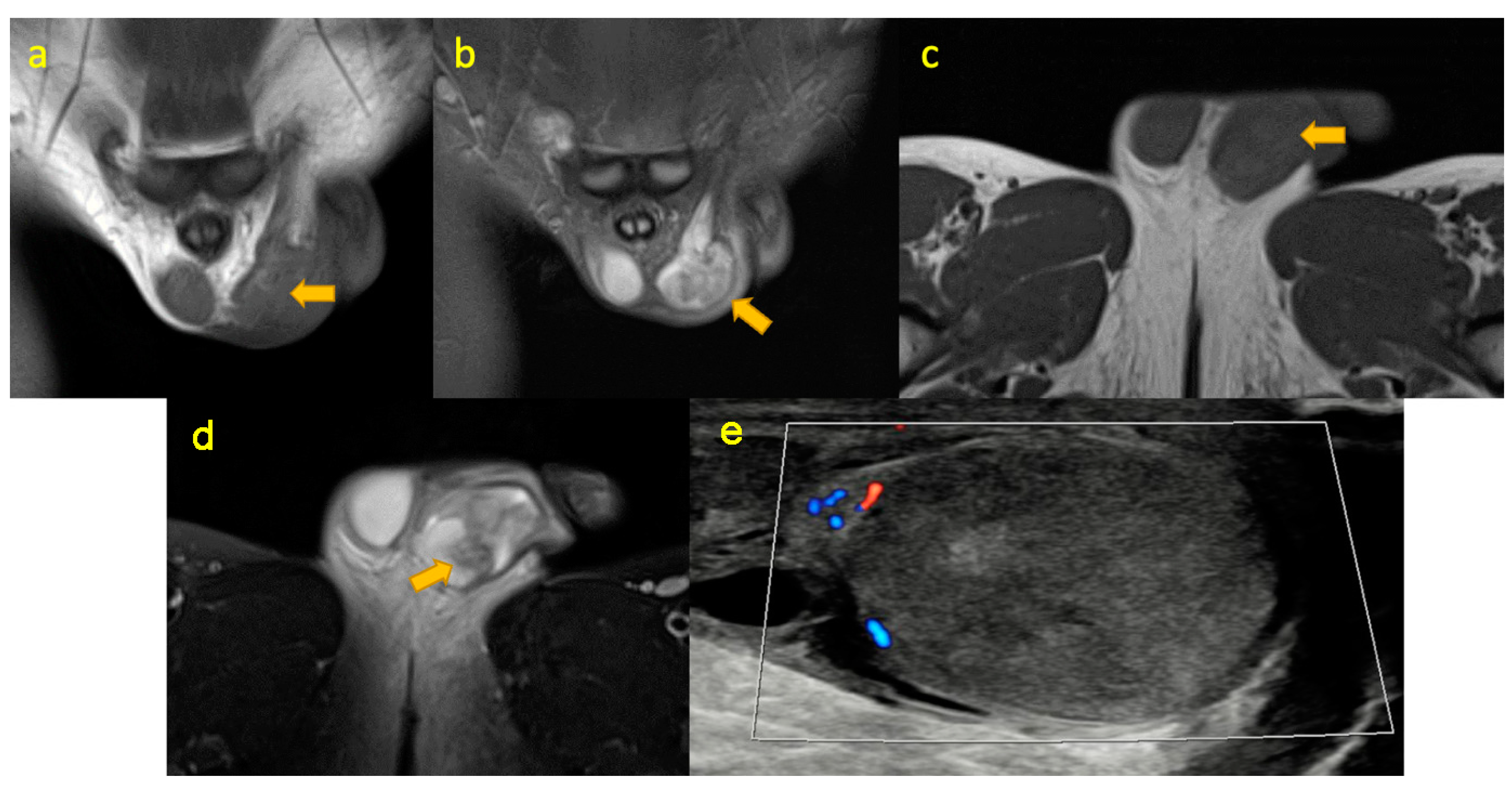 Pediatrrep 17 00014 g016