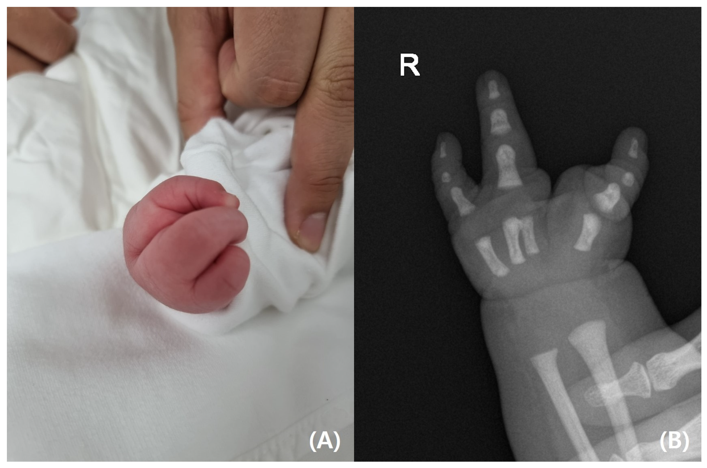 Pediatrrep 17 00047 g002