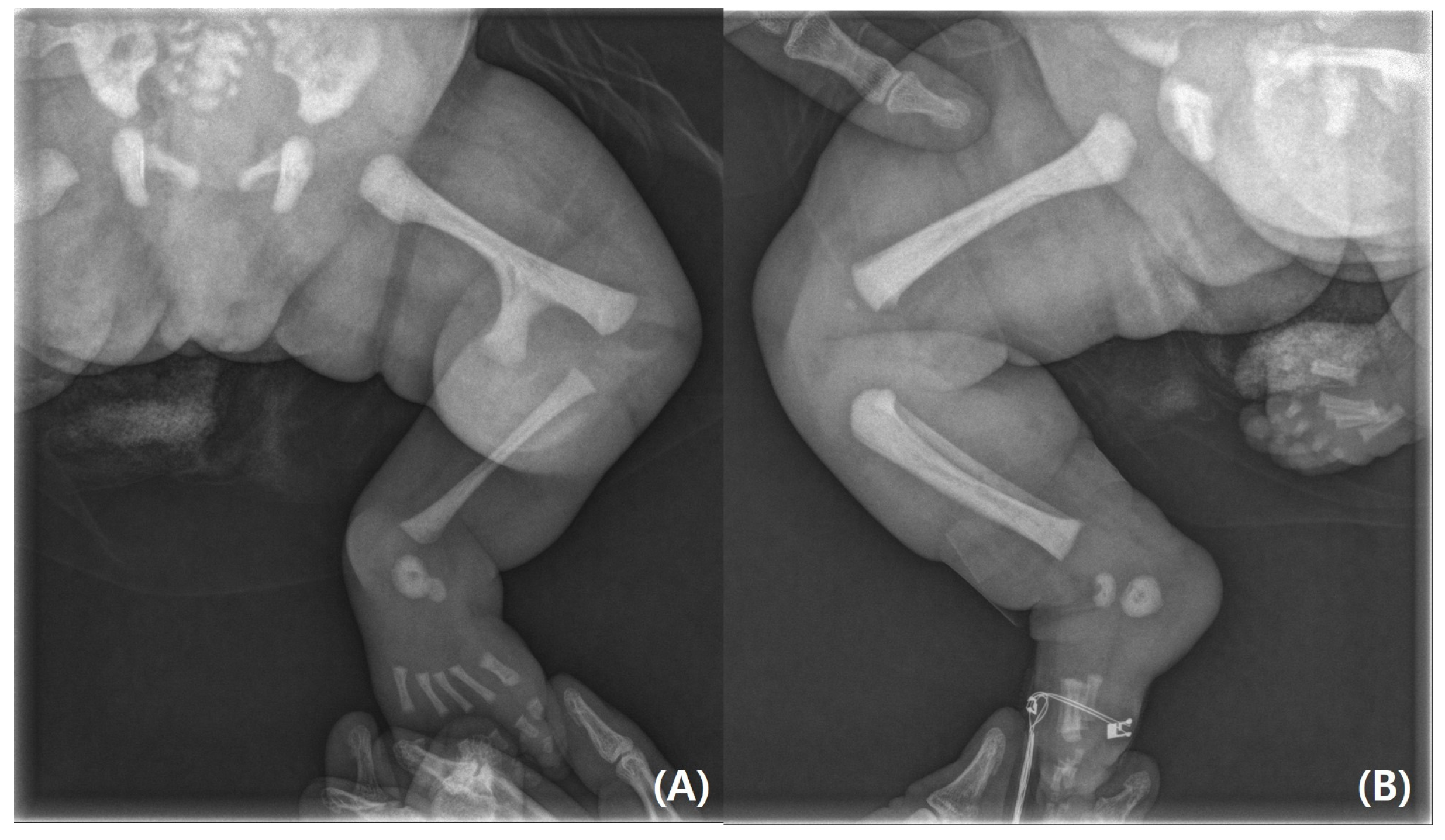 Pediatrrep 17 00047 g003