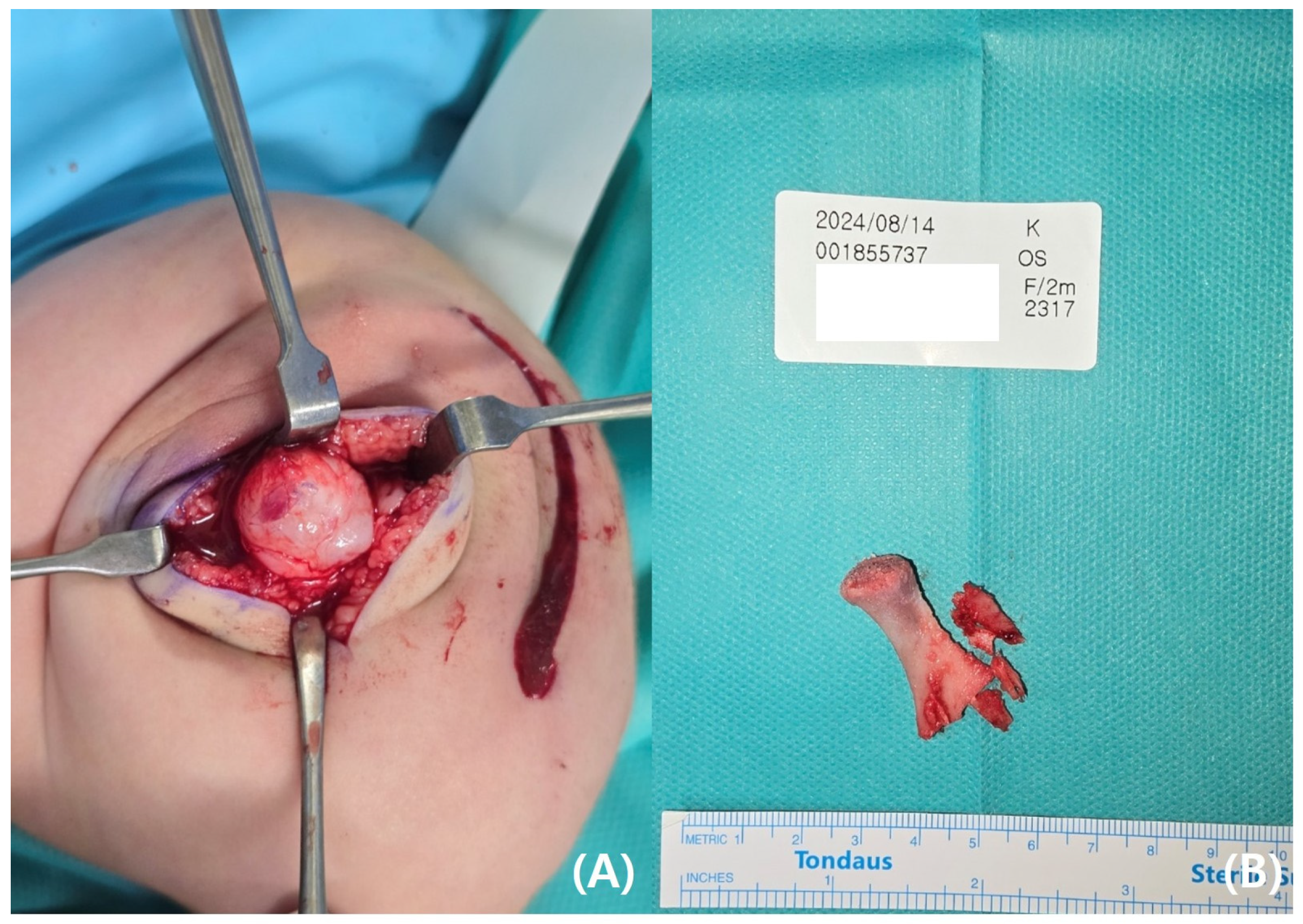 Pediatrrep 17 00047 g004