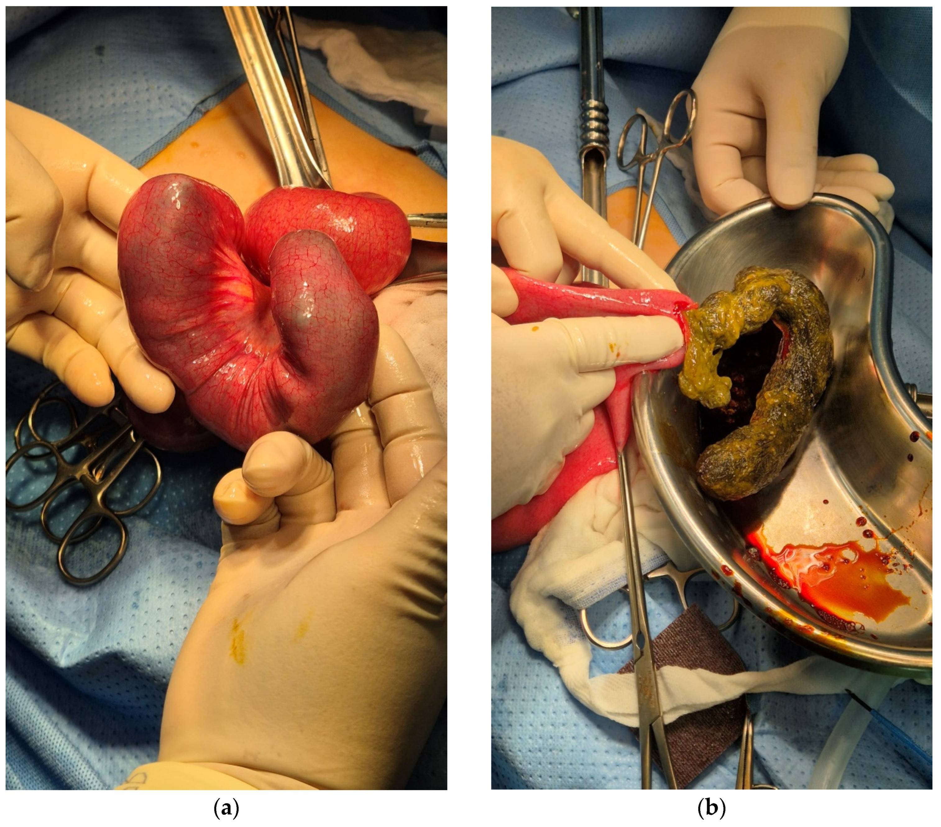 Pediatrrep 17 00053 g003