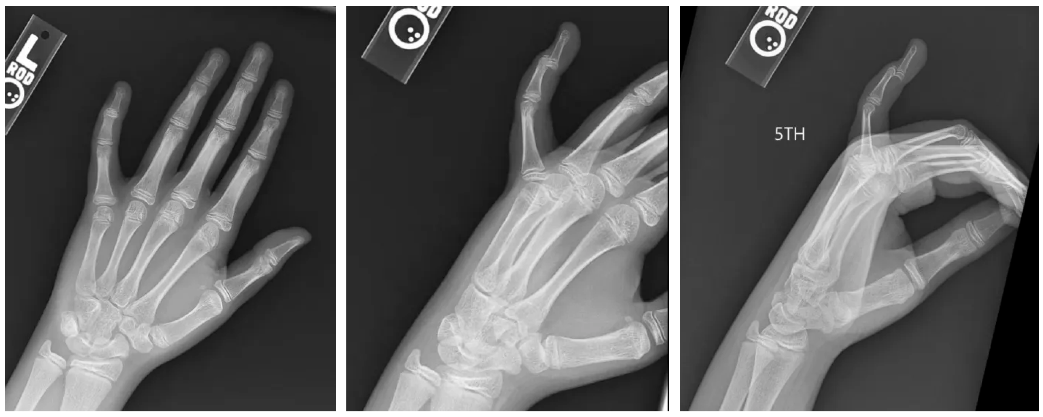 Pediatrrep 17 00082 g001