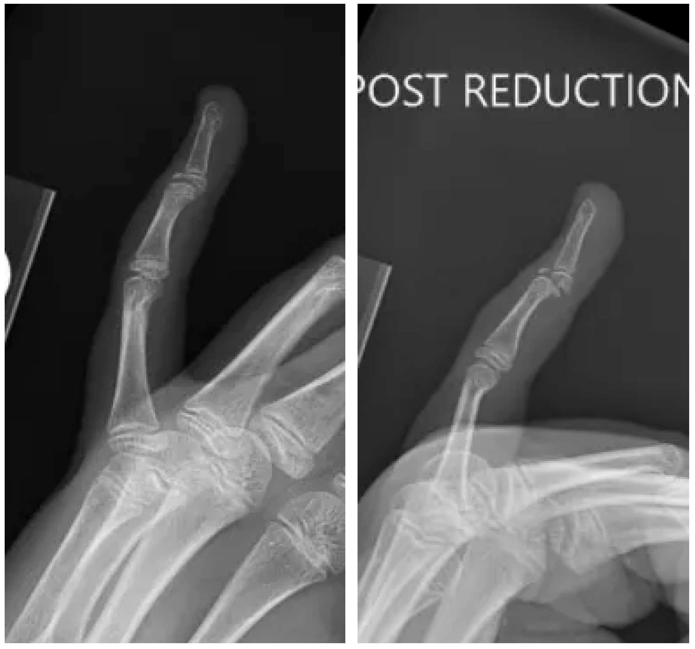 Pediatrrep 17 00082 g002