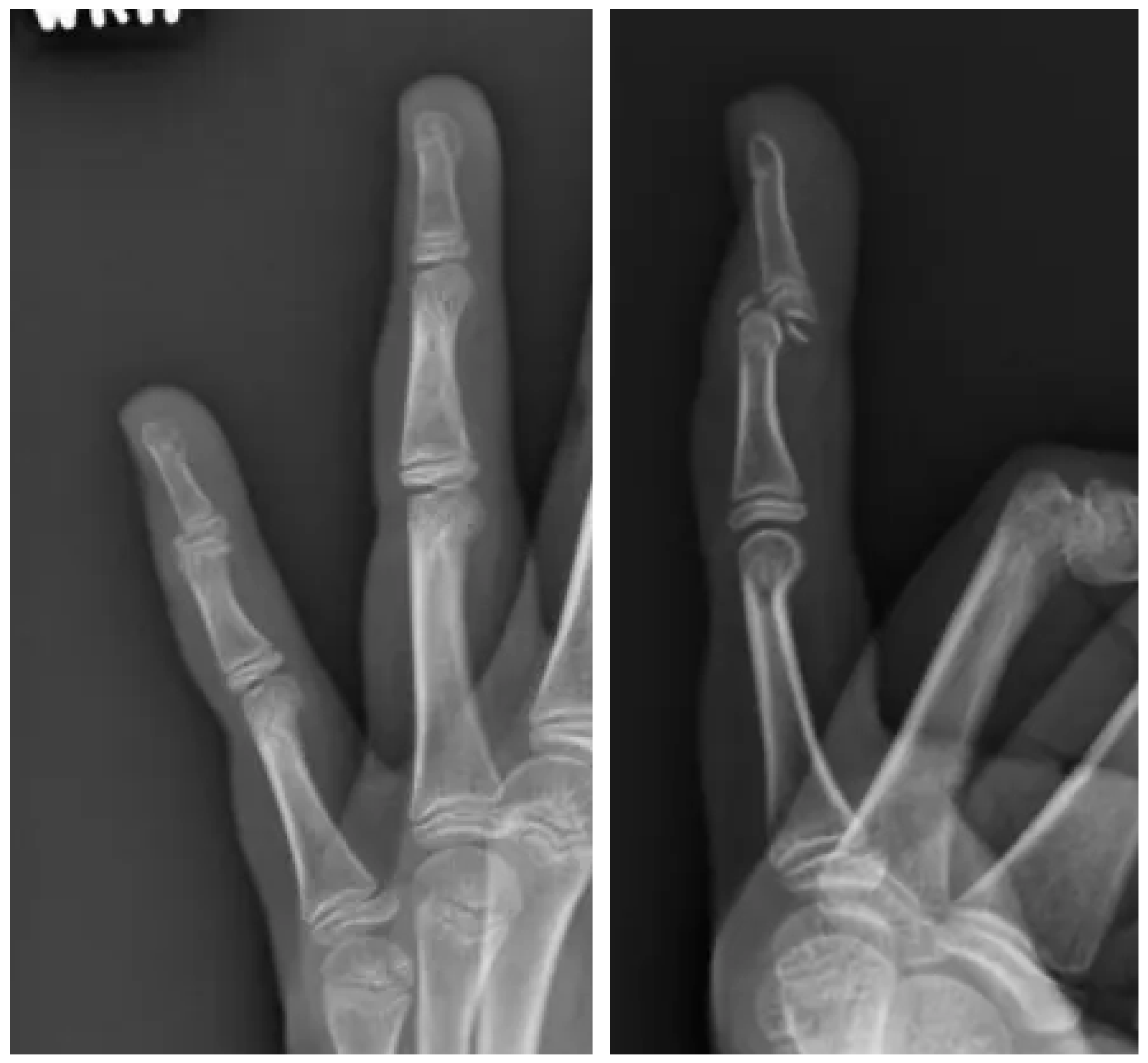 Pediatrrep 17 00082 g003