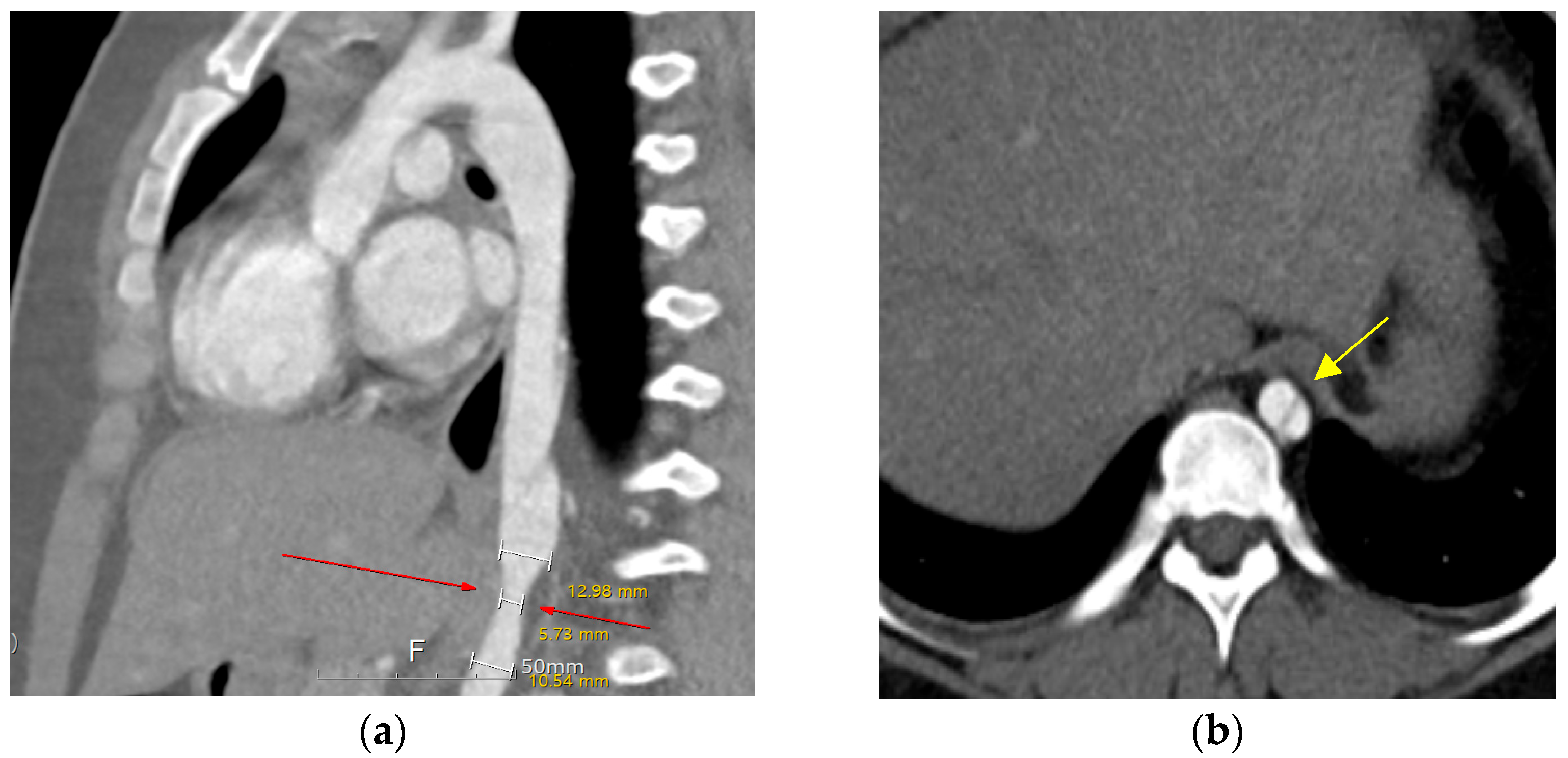 Pediatrrep 17 00084 g001