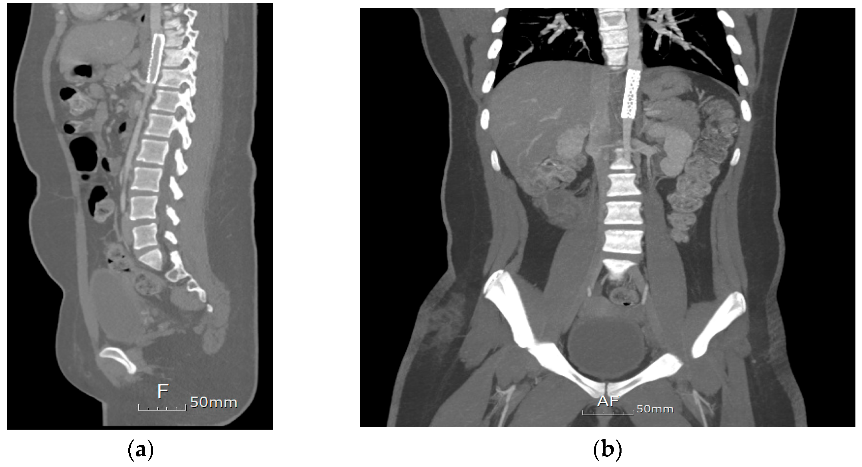 Pediatrrep 17 00084 g003