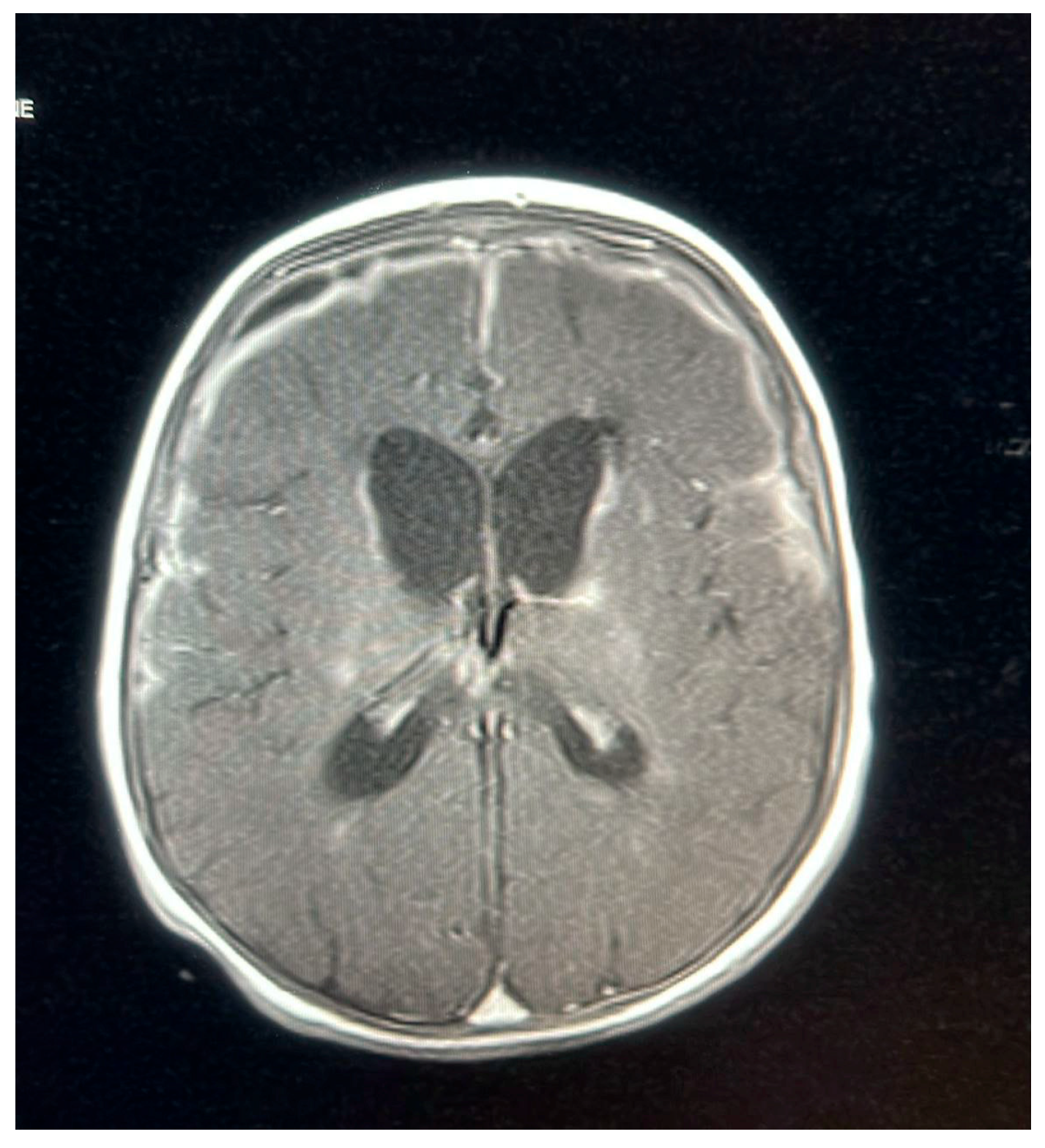 Pediatrrep 17 00094 g003