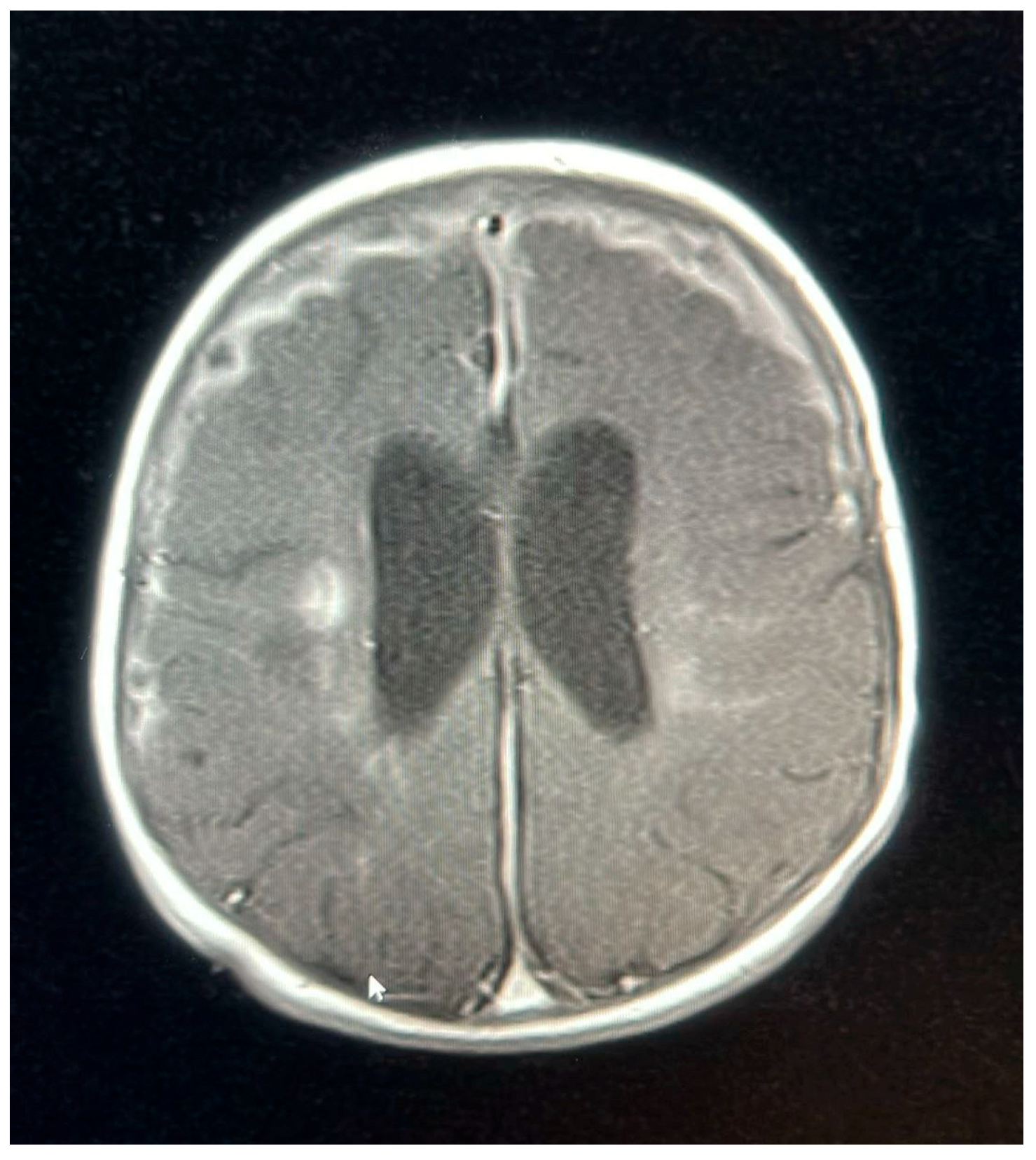 Pediatrrep 17 00094 g004