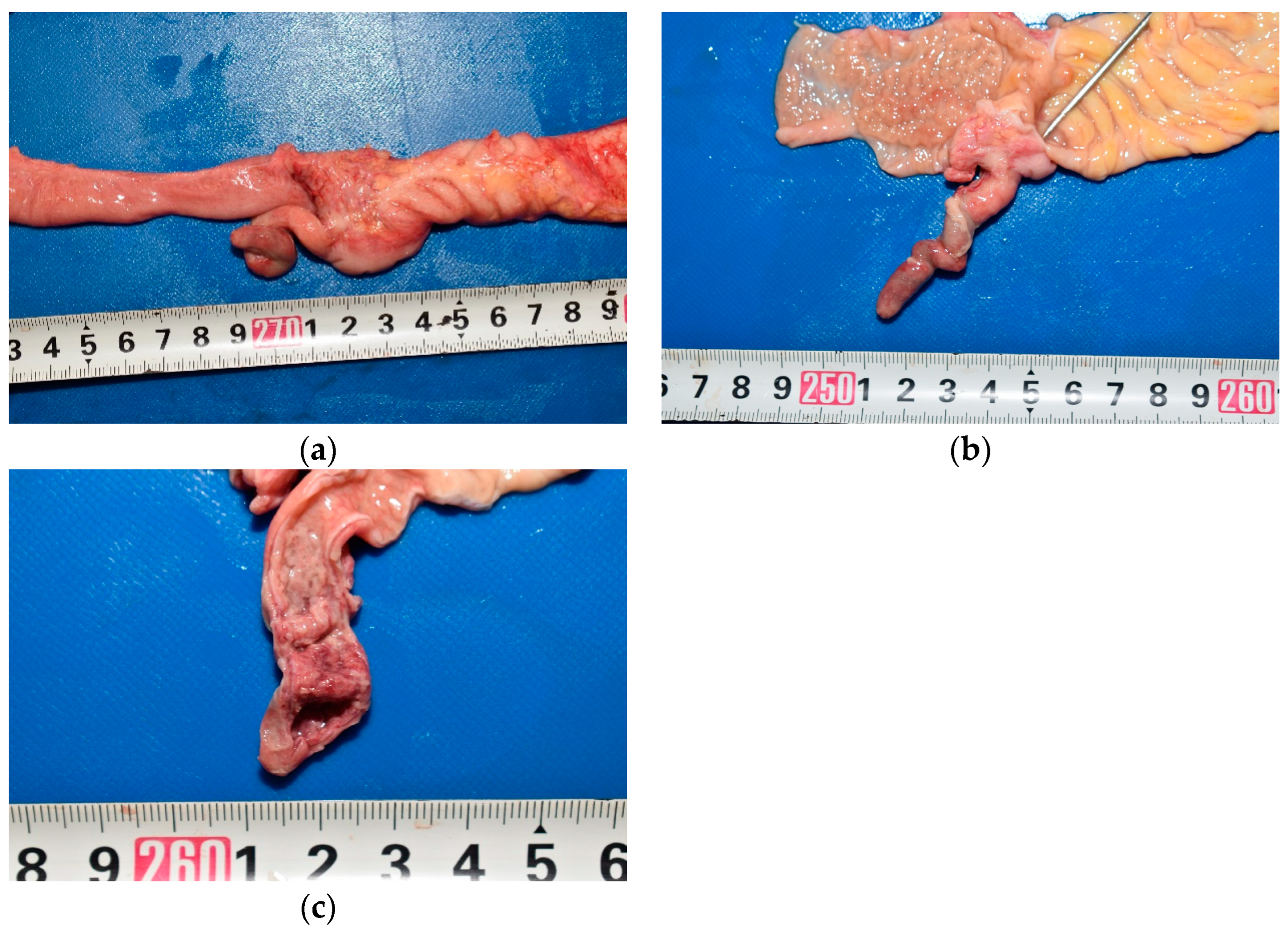 Pediatrrep 17 00096 g002