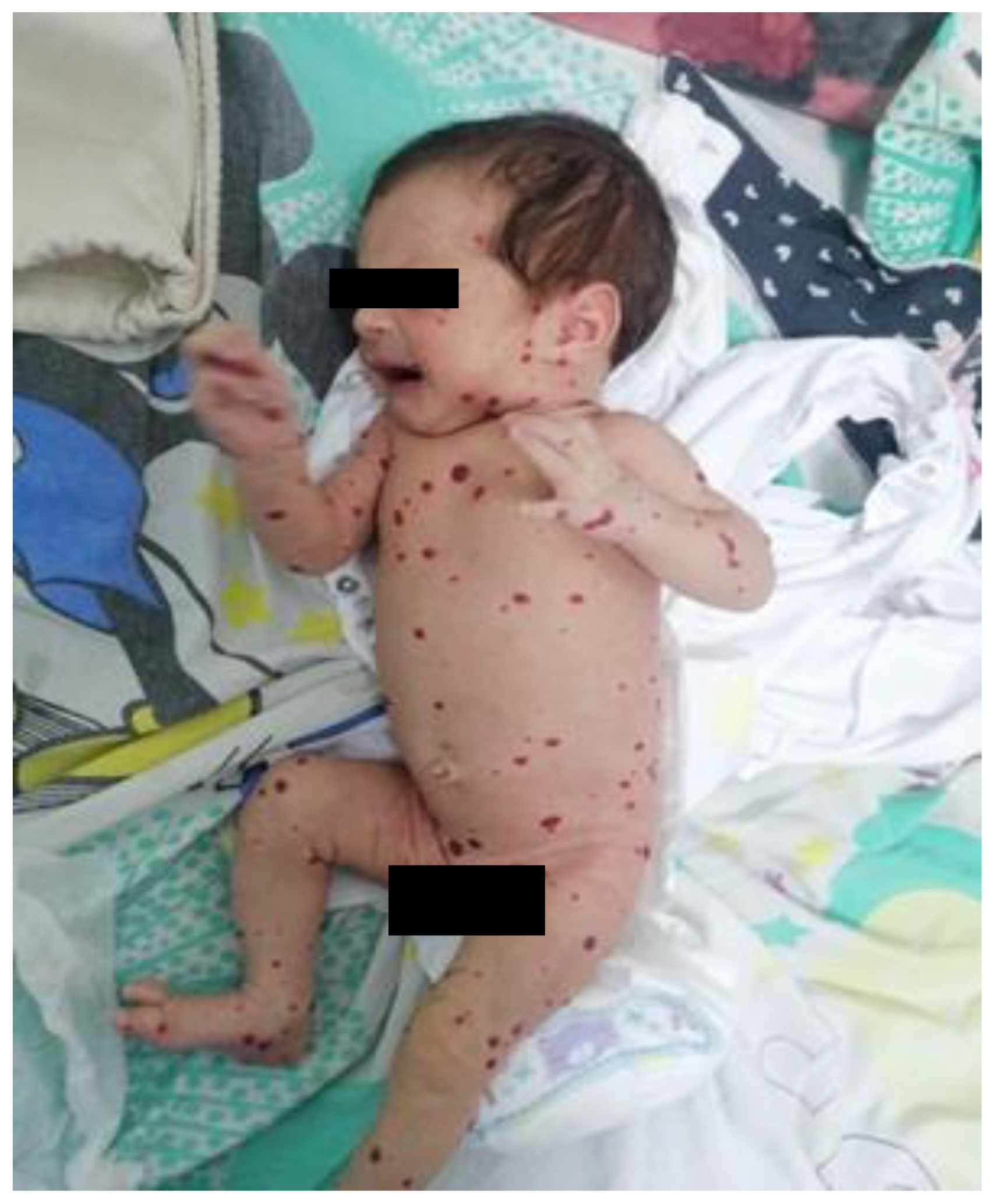 Pediatrrep 17 00102 g001