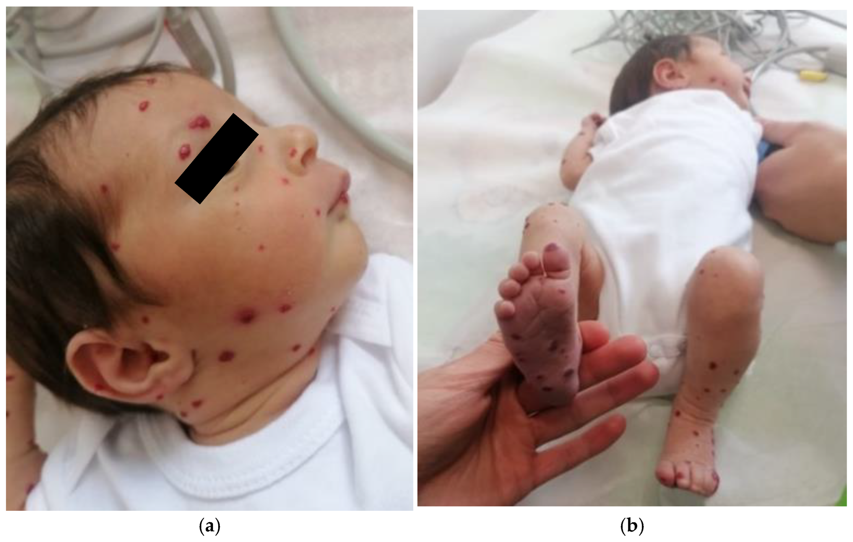 Pediatrrep 17 00102 g003