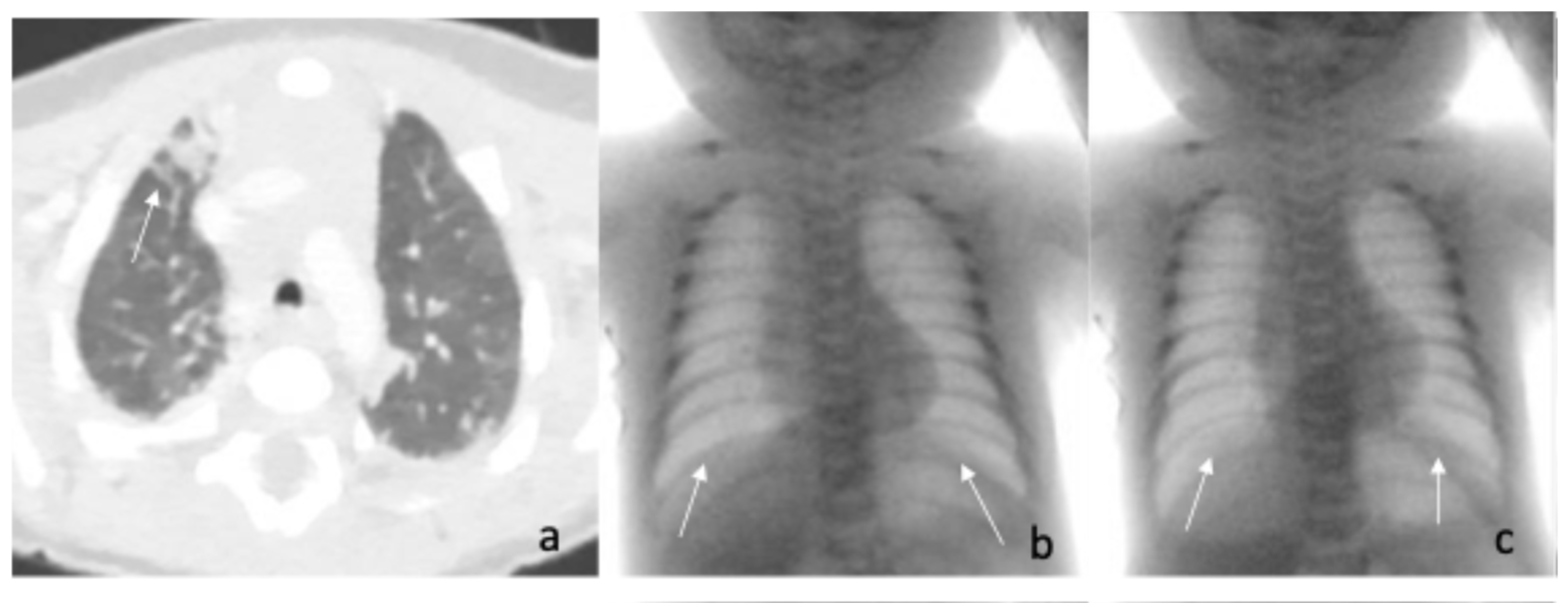 Pediatrrep 17 00127 g003