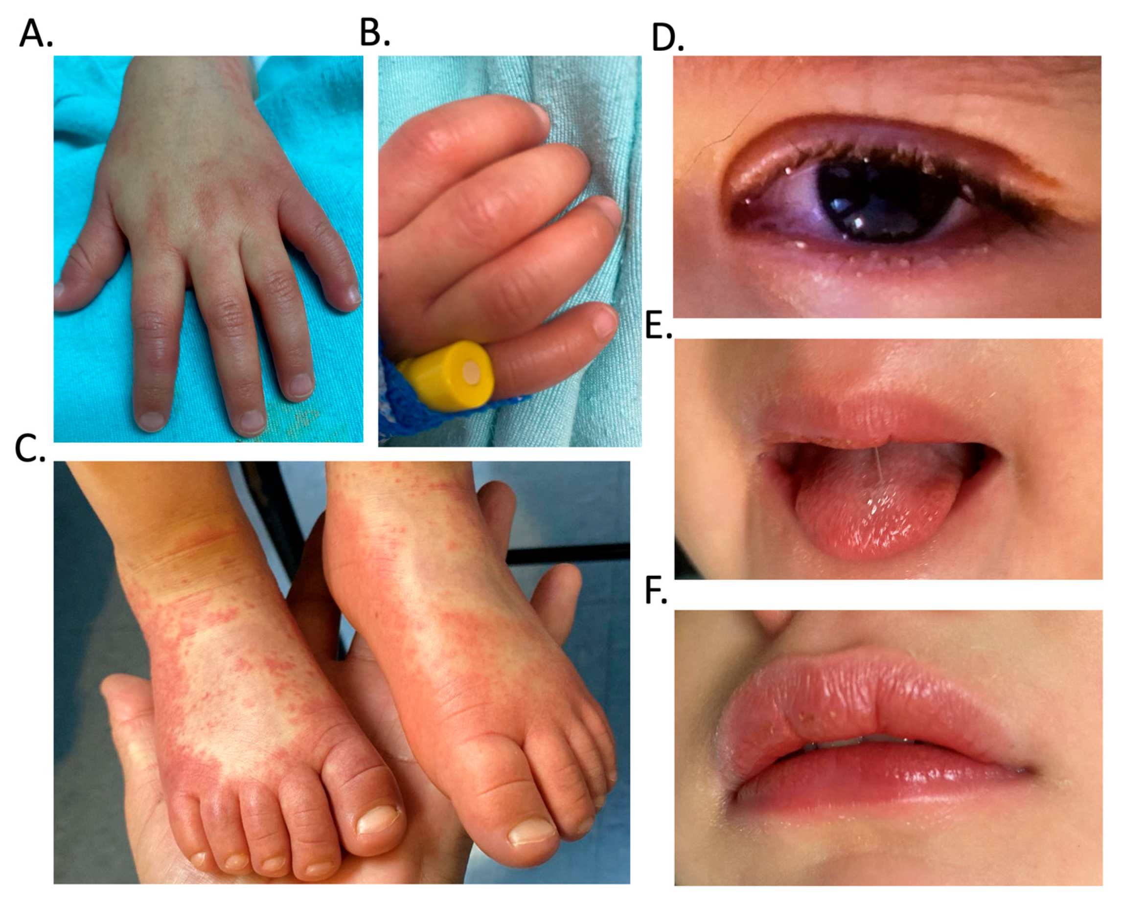 Pediatrrep 17 00128 g001