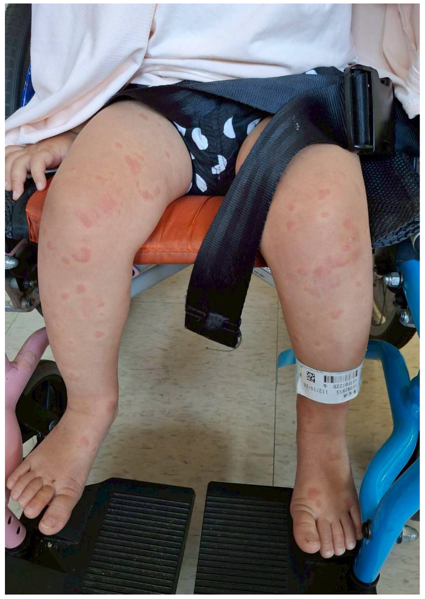 Pediatrrep 18 00002 g002