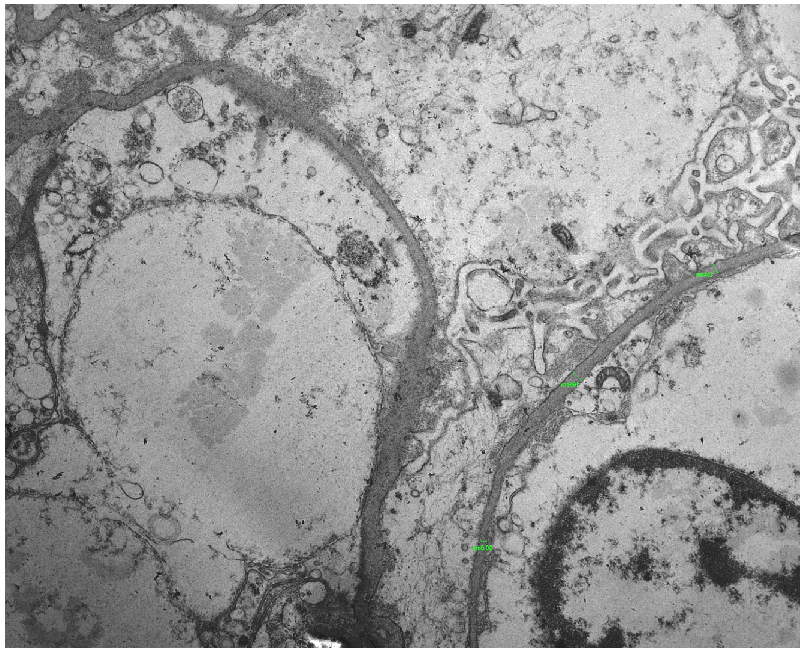 Pediatrrep 18 00003 g002