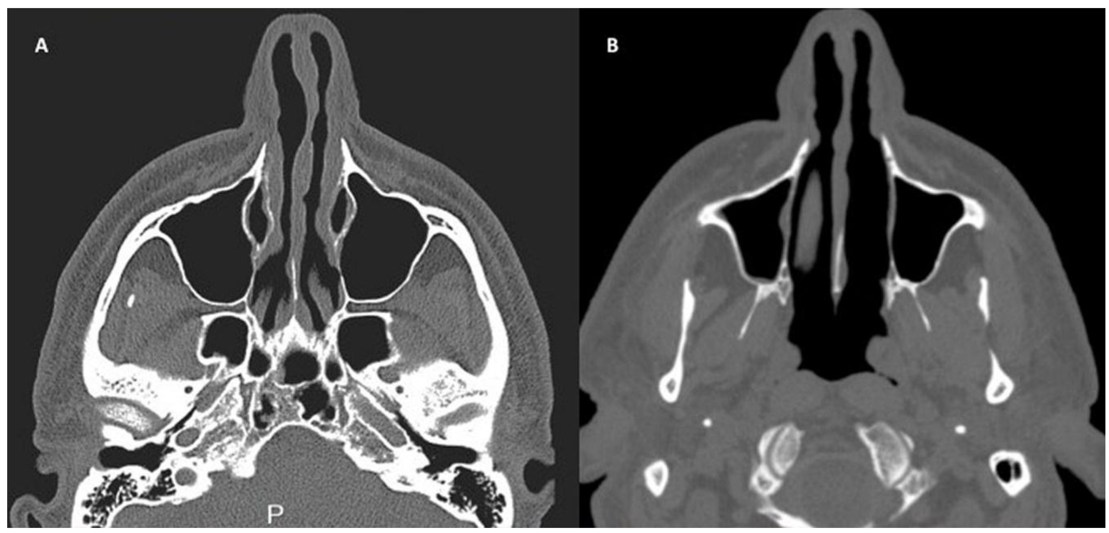 Pharmaceuticals 10 00053 g004