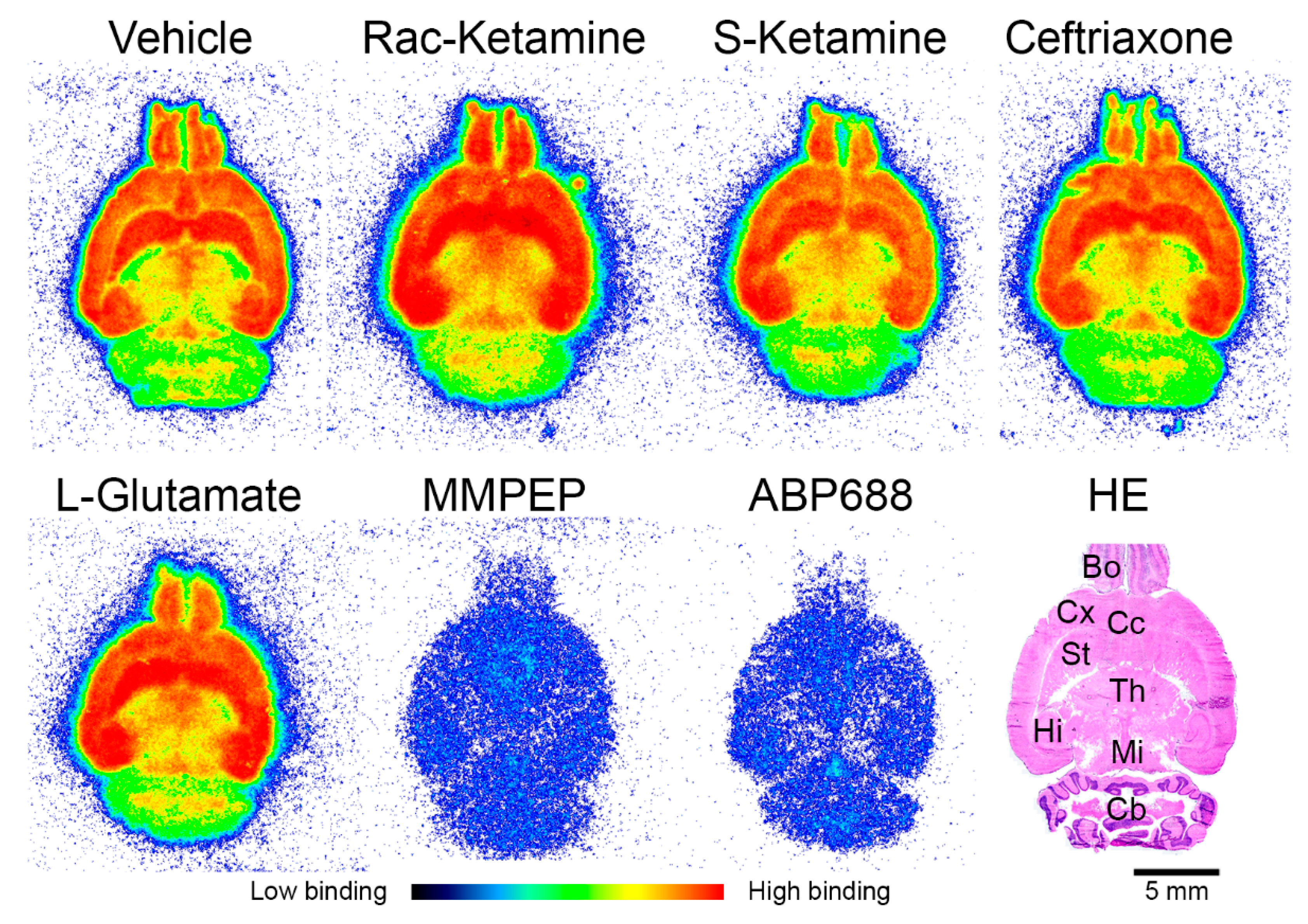 Pharmaceuticals | Free Full-Text | Ketamine and Ceftriaxone-Induced 