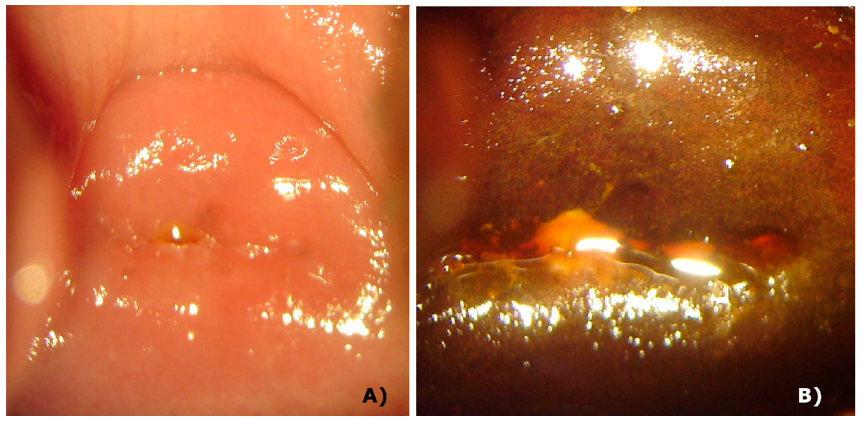 Pharmaceuticals 12 00107 g005