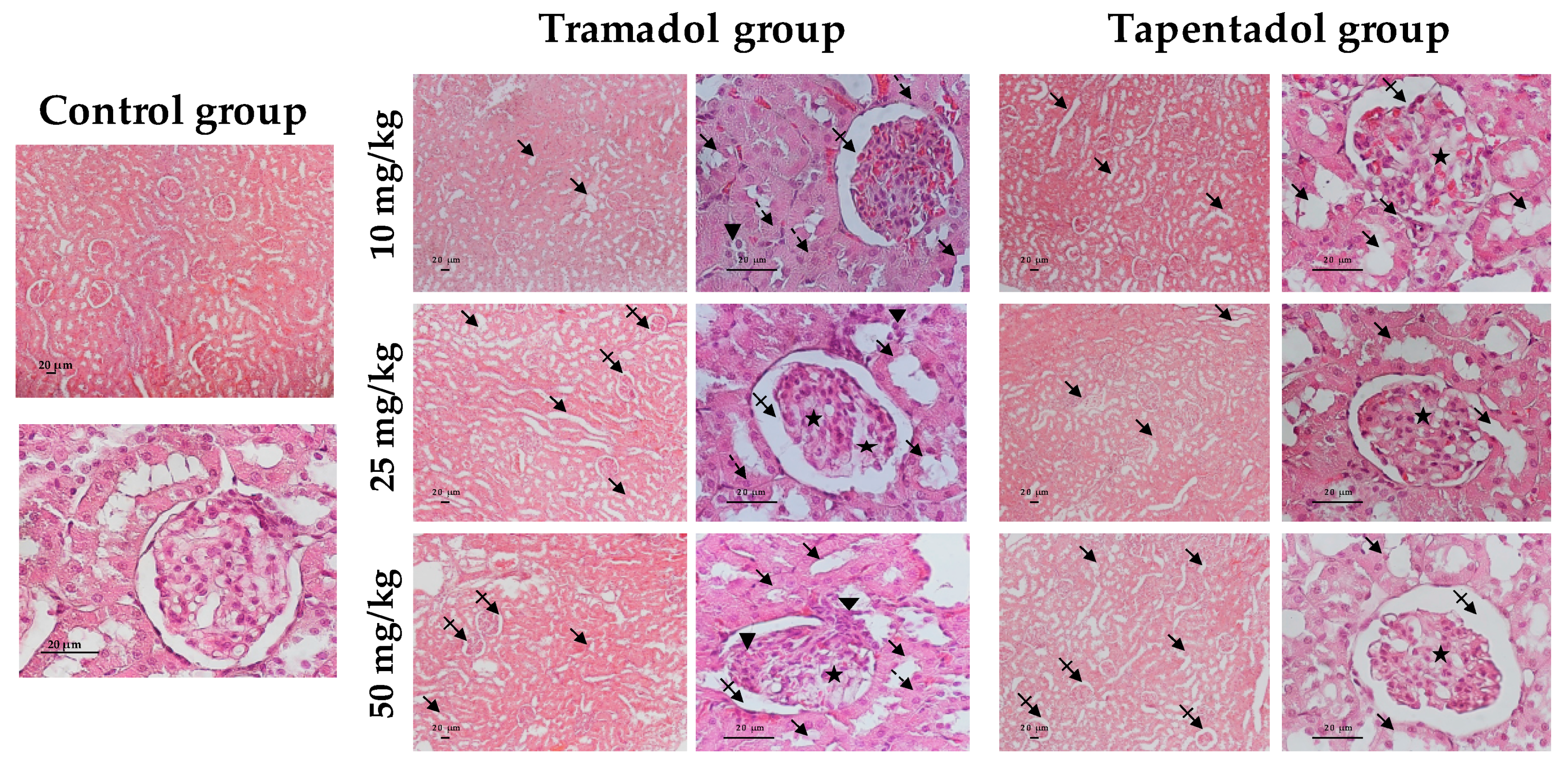 Pharmaceuticals Free Full Text Repeated Administration Of Clinical Doses Of Tramadol And Tapentadol Causes Hepato And Nephrotoxic Effects In Wistar Rats Html Pharmaceuticals Free Full Text Repeated Administration Of Clinical Doses Of Tramadol And Tapentadol Causes Hepato And Nephrotoxic Effects In Wistar Rats Html