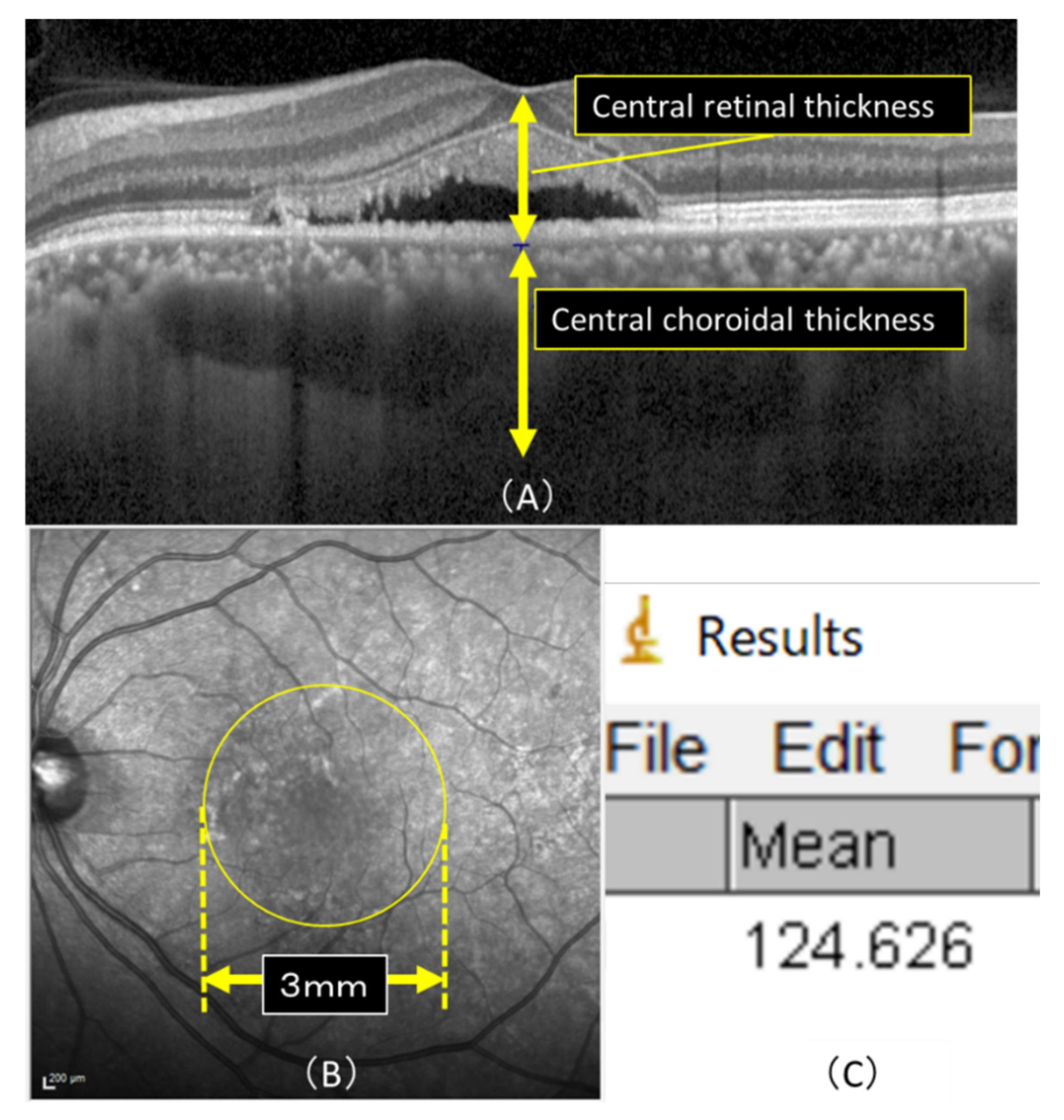 Pharmaceuticals 14 00053 g005